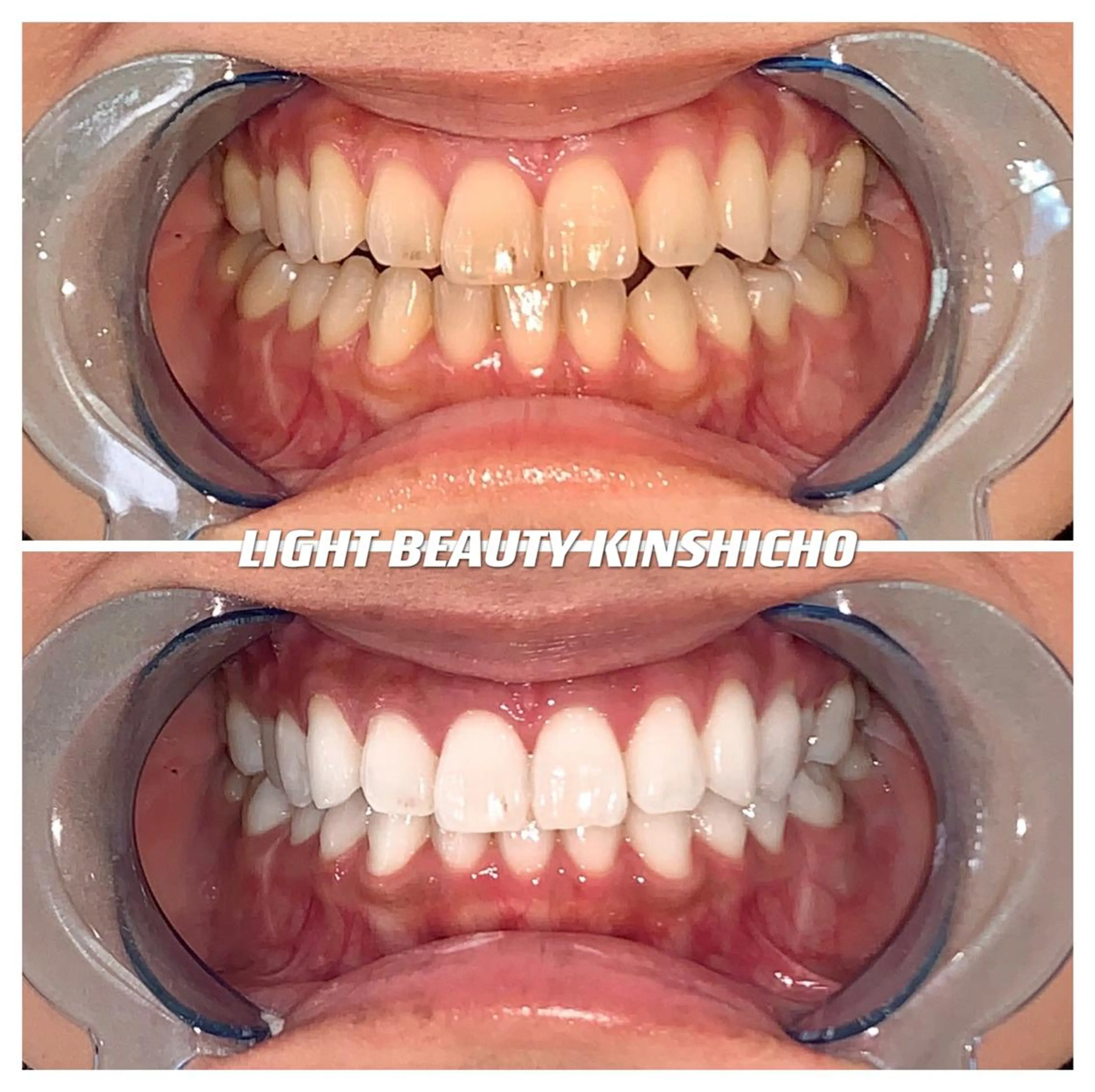 メンズ ライトビューティー 錦糸町店のエステ・リラクイメージ