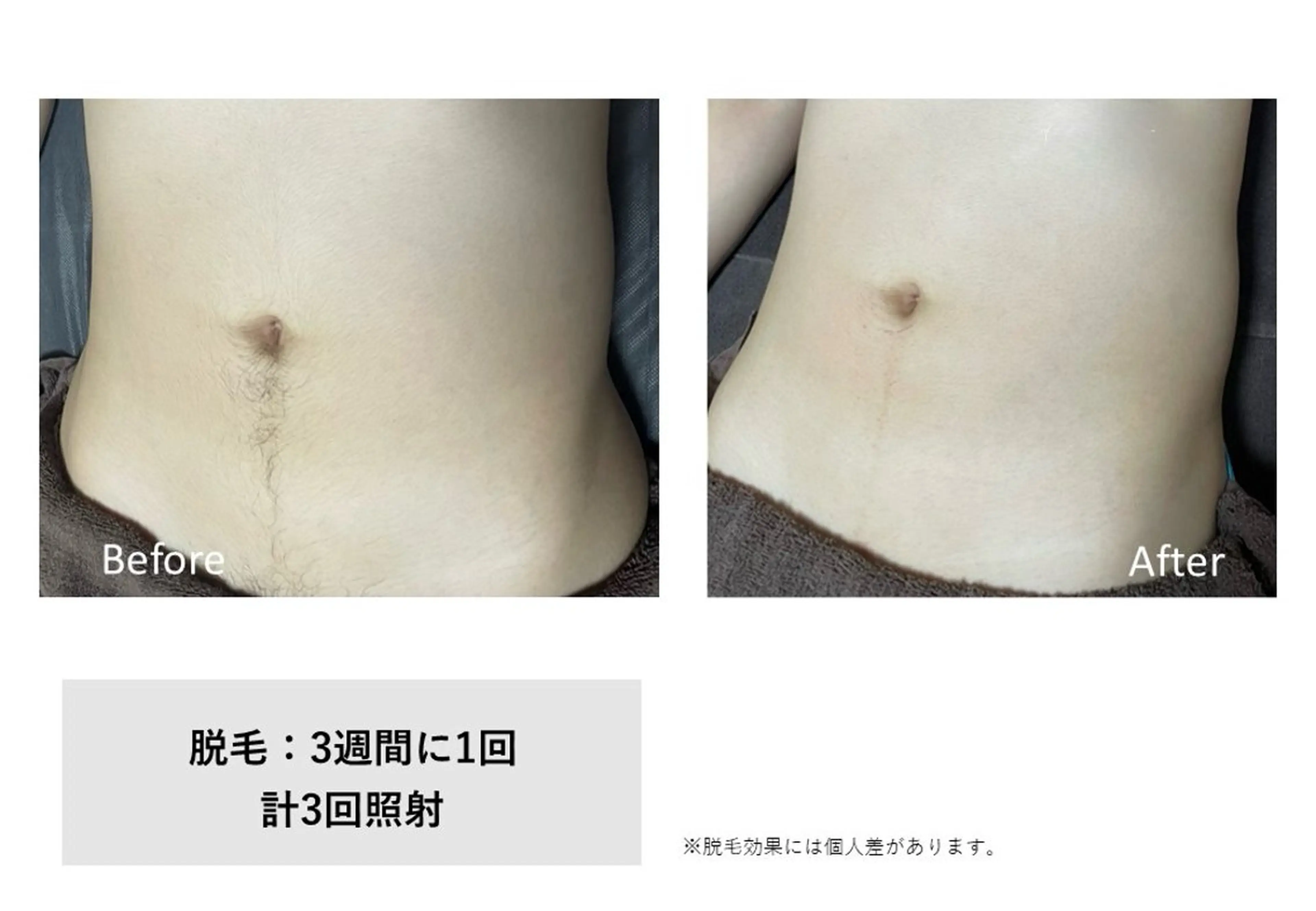 RIKKA所属・RIKKA☆脱毛/ アイブロウ/メイクのエステ・リラクイメージ