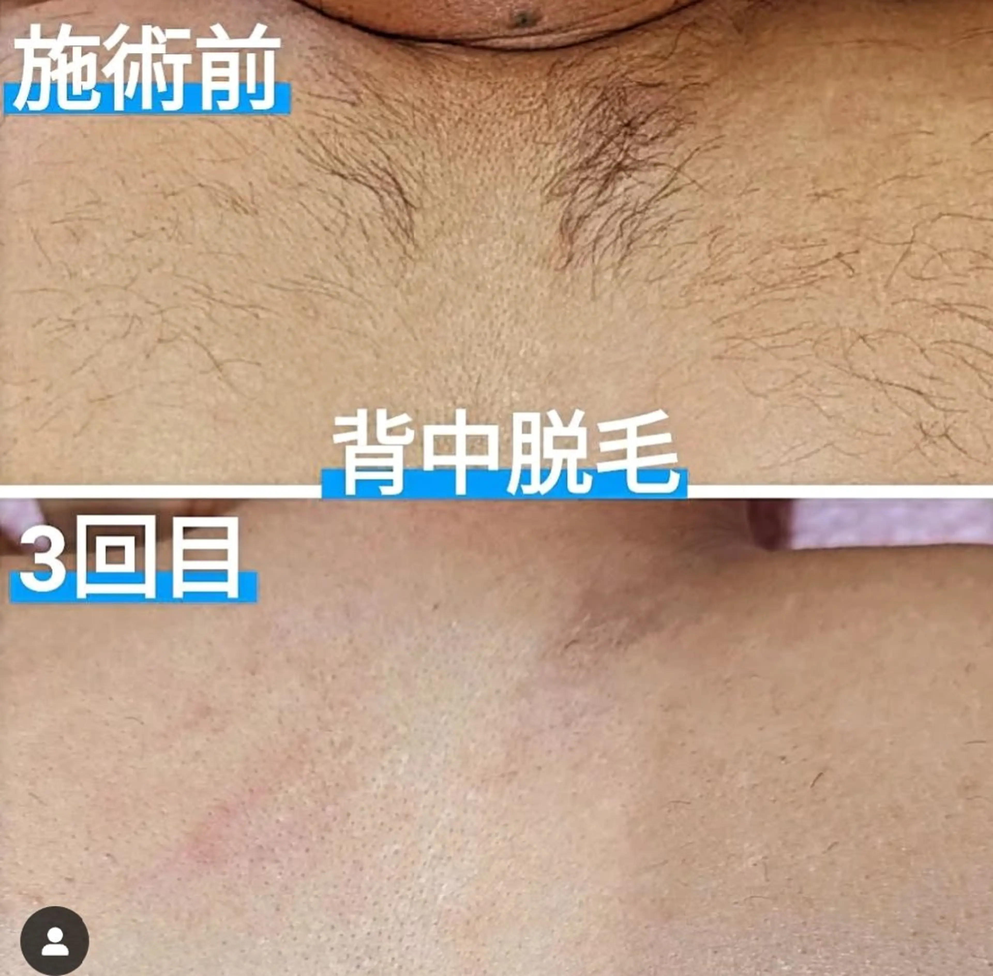 メンズ 姫路御立脱毛サロンSClass.所属・姫路御立脱毛サロン S Class.のエステ・リラクイメージ