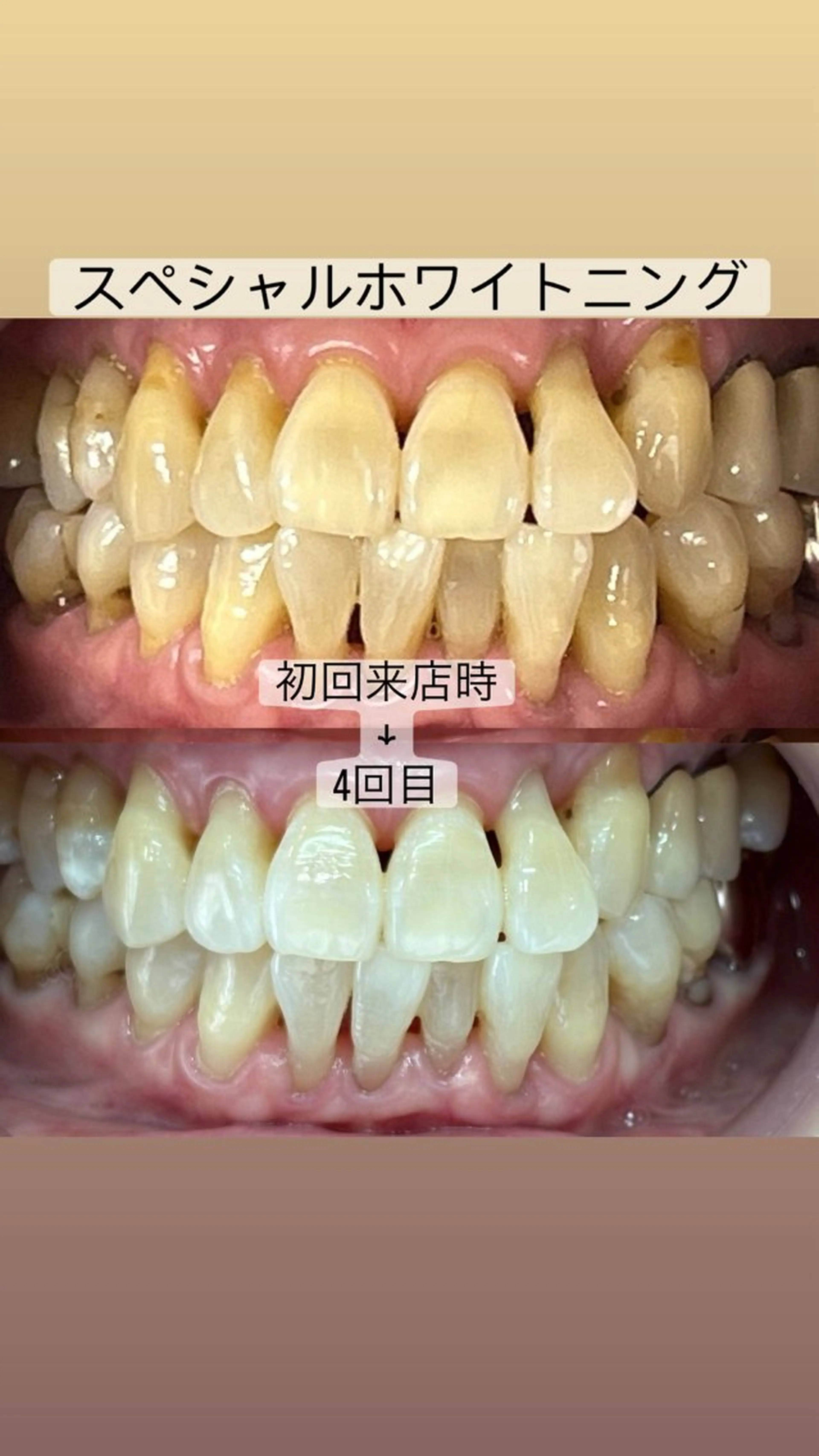 その他 whitening salon yatto.所属・ホワイトニングサロン yatto.のその他イメージ