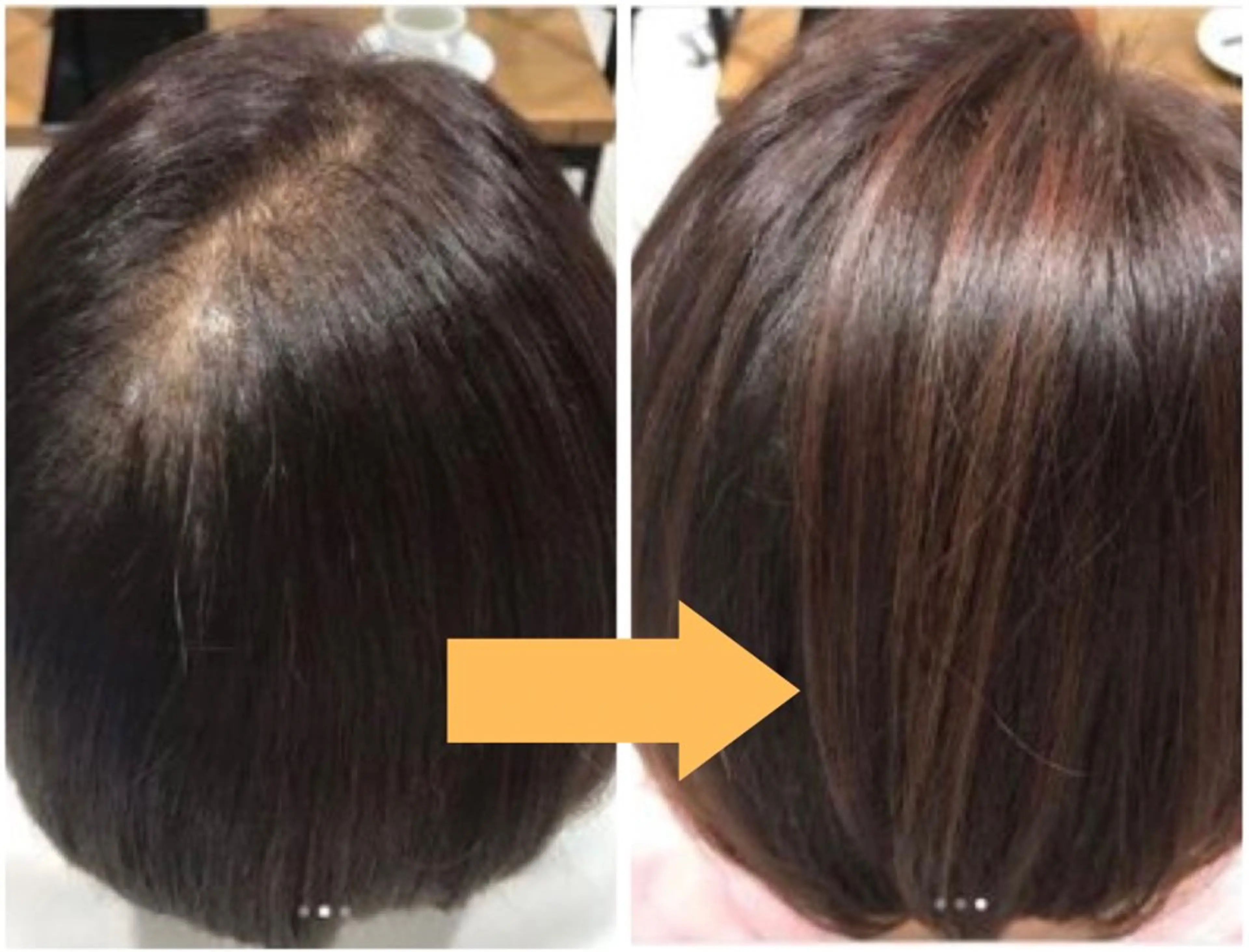 bellissimo 【ベリッシモ】所属・ちひろ　痩身/ハーブ bellissimoのエステ・リラクイメージ