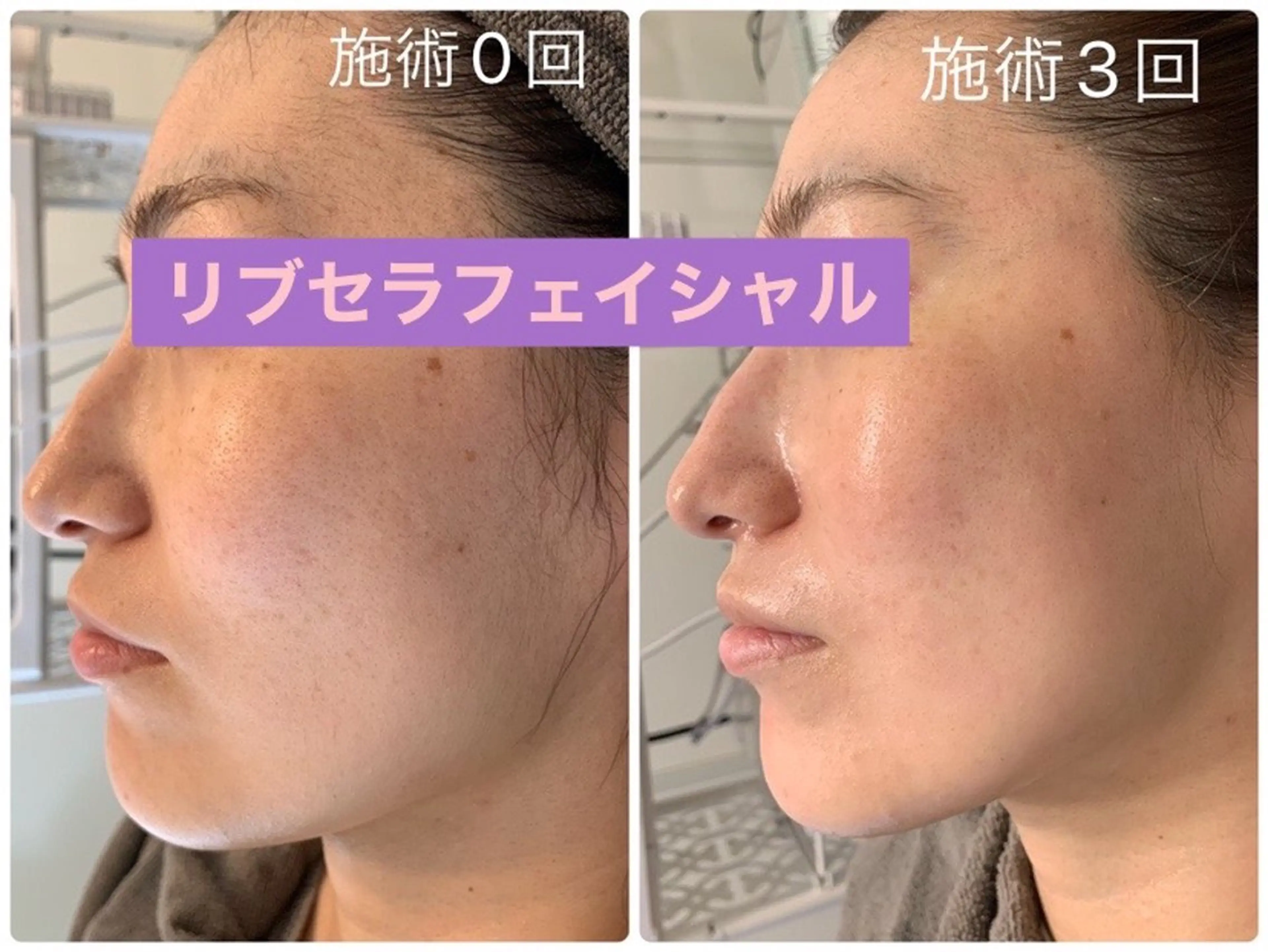 エステ Private Salon Prunelle所属・プライベートサロン プリュネルのエステ・リラクイメージ