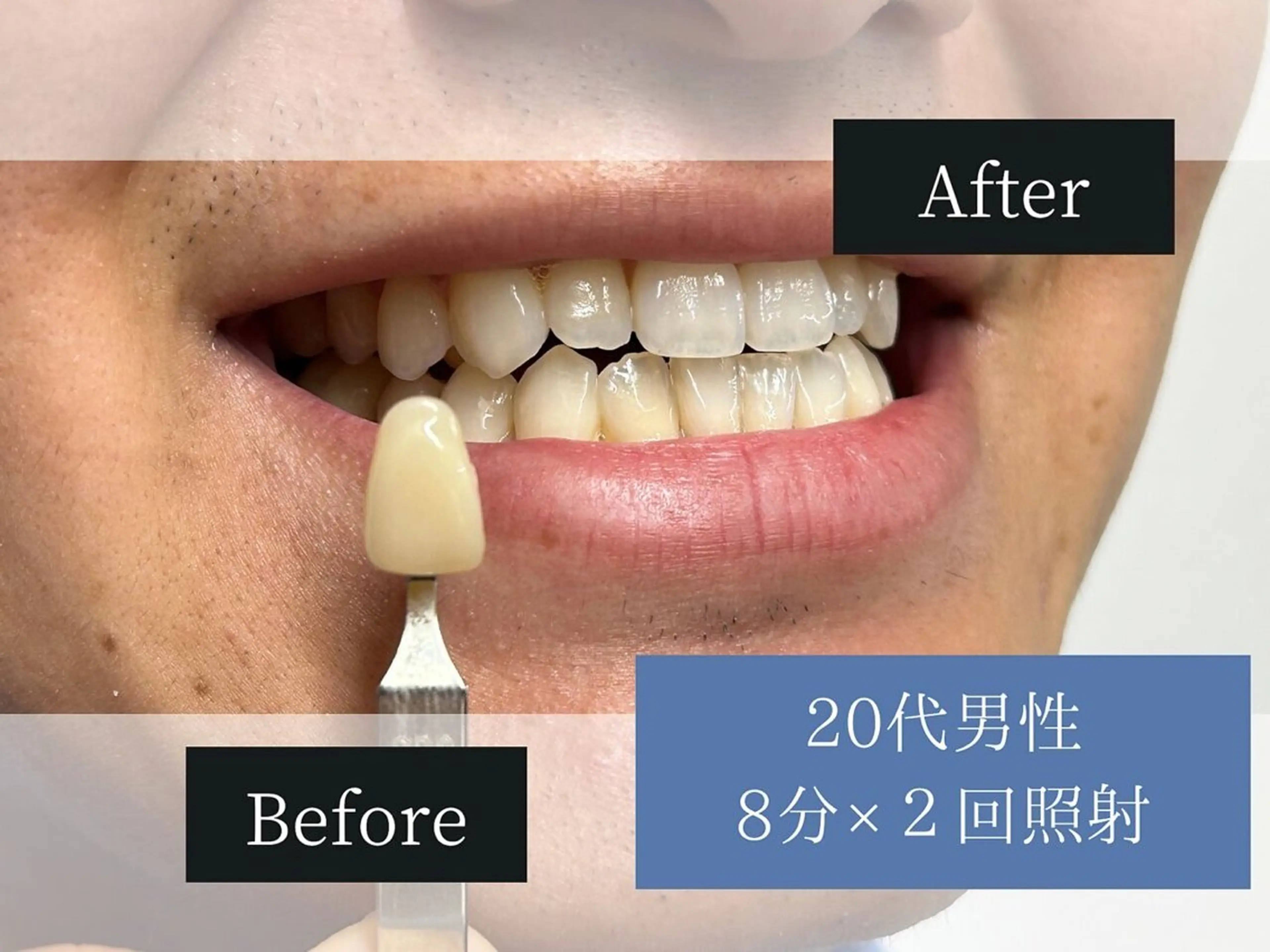 ホワイトニングカフェ中野店所属・ホワイトニングカフェ 中野店のその他イメージ