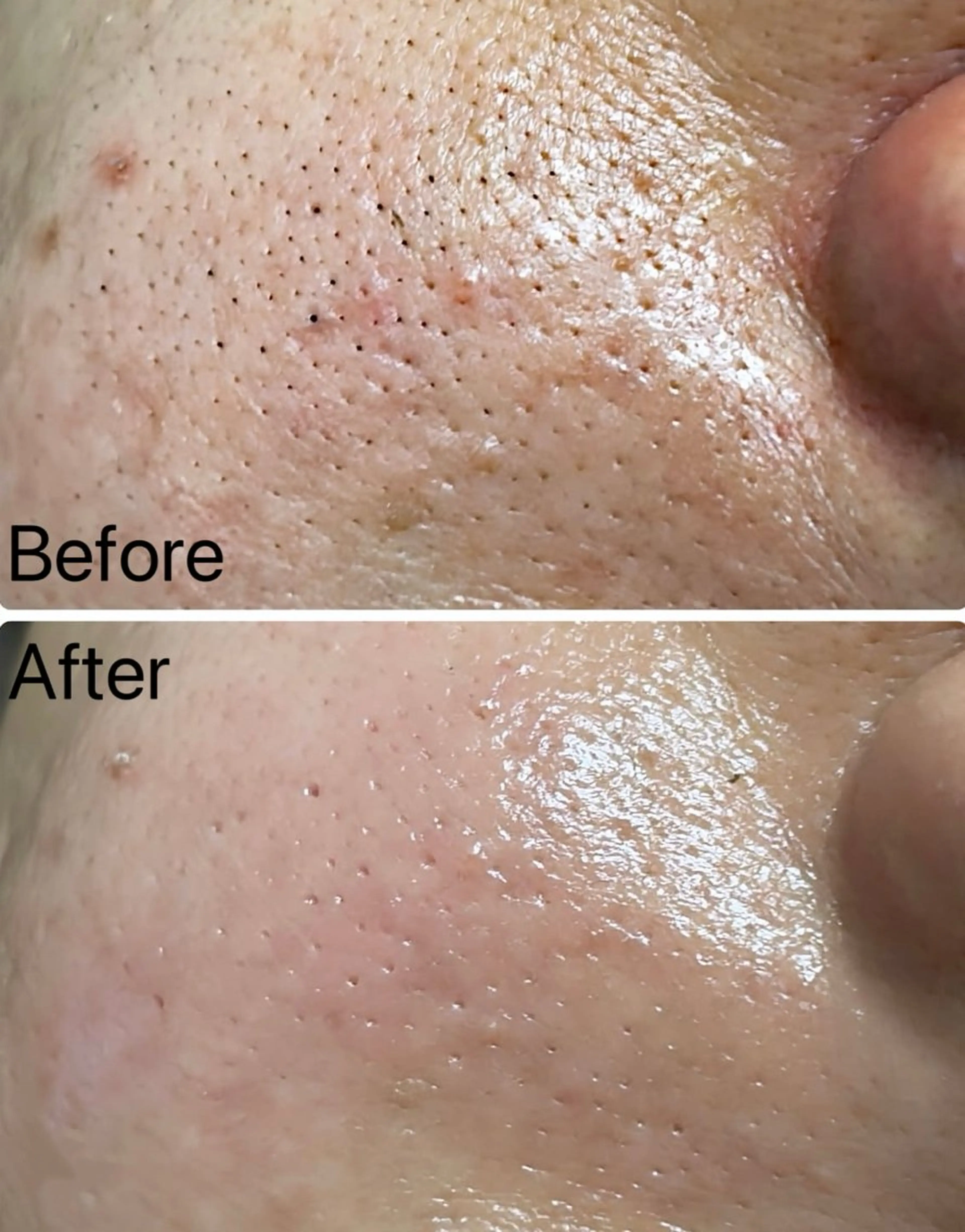 Belle原宿所属・佐藤 加奈のエステ・リラクイメージ