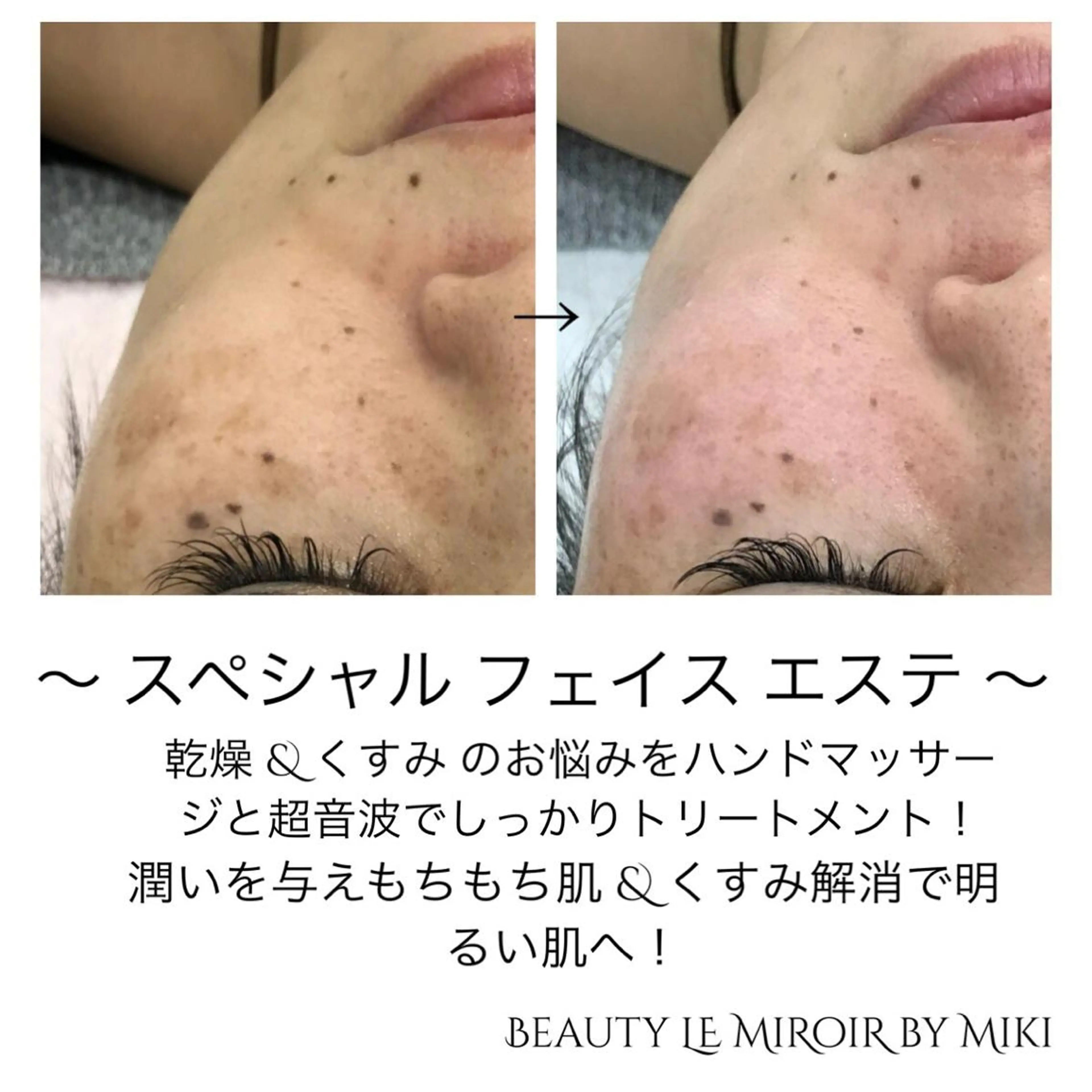 ビューティー ミロワールのエステ・リラクイメージ