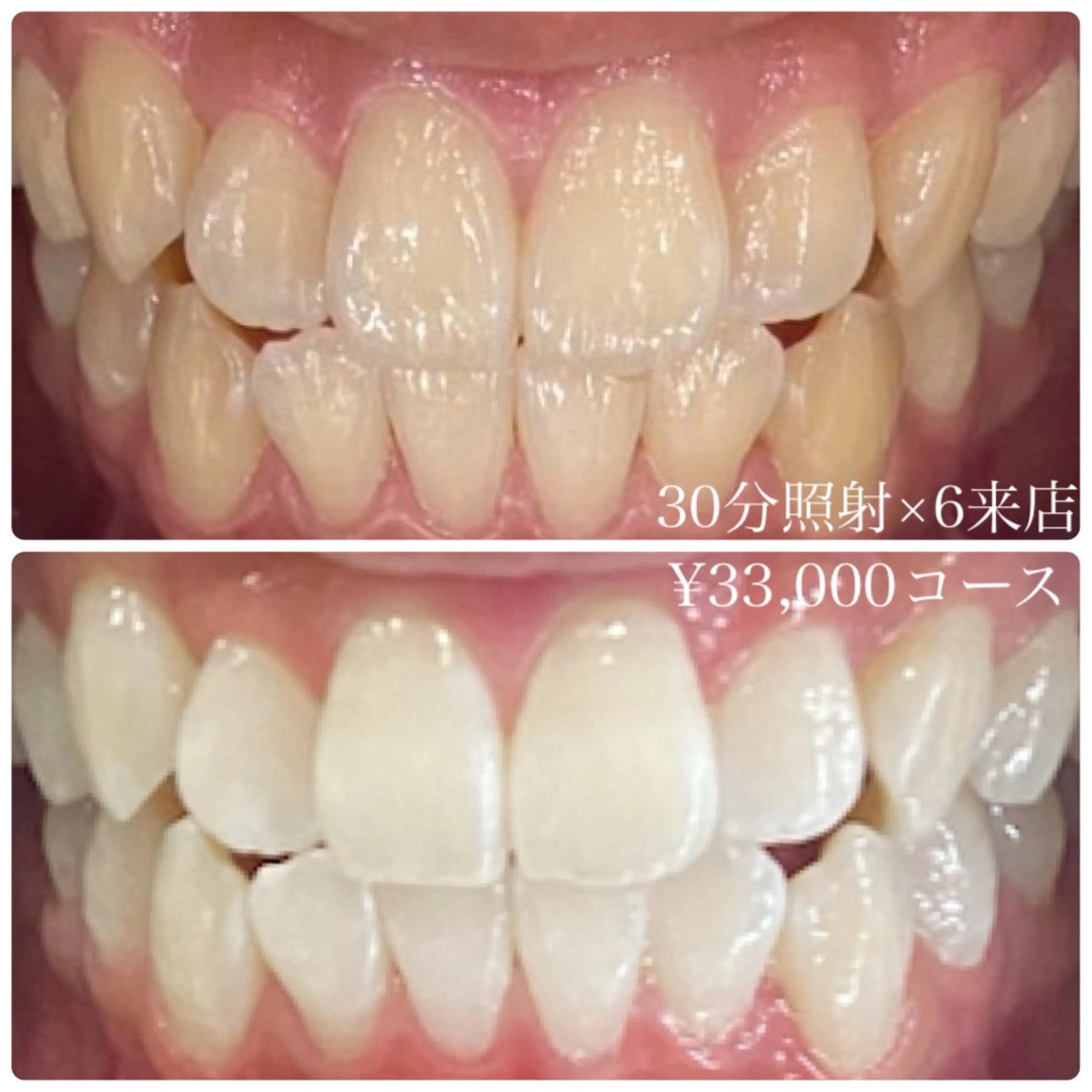 メンズ その他 ホワイトニングルーム 川崎店所属・ホワイトニング ルーム 川崎店のその他イメージ