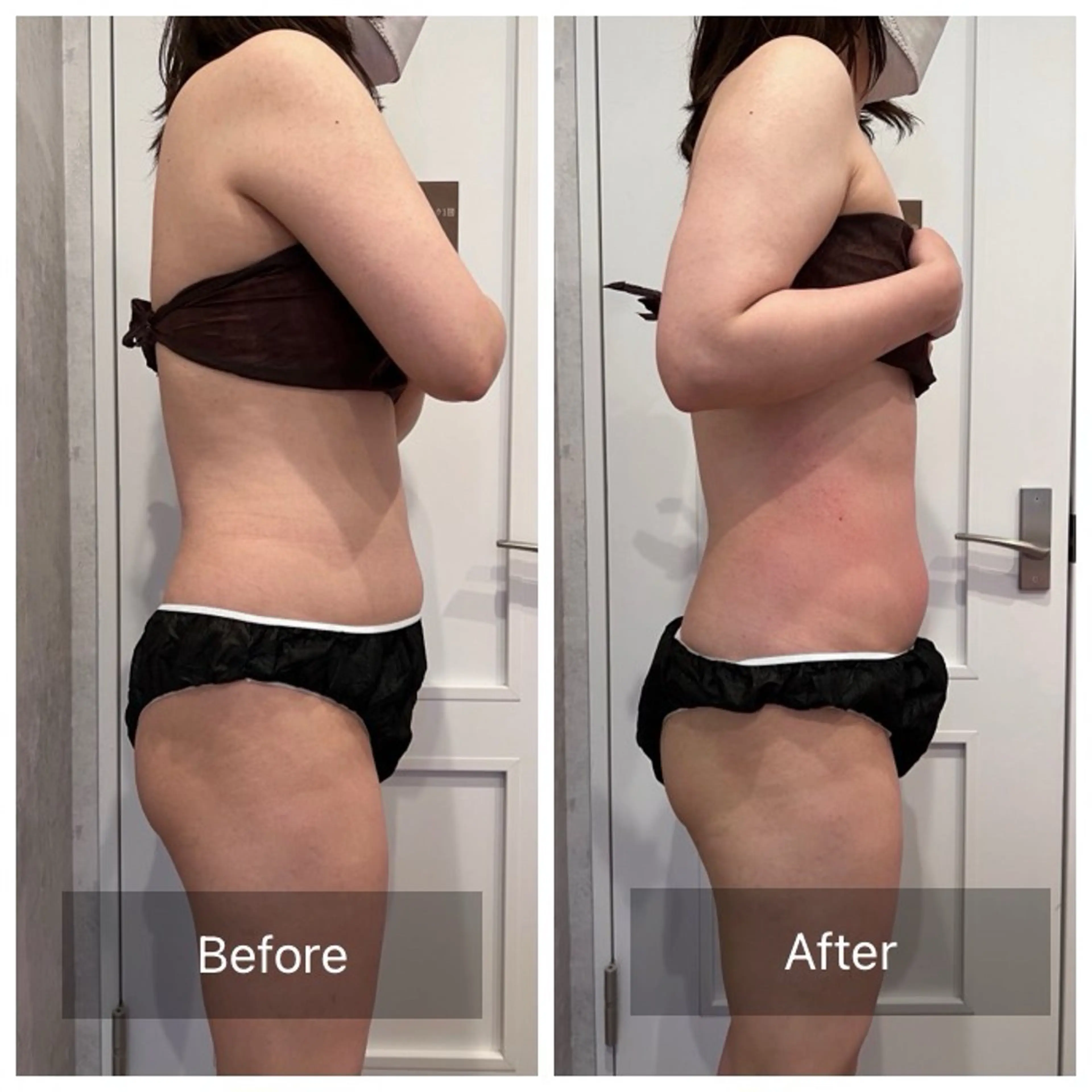 【4周年特価キャンペーン🉐】本格痩身×選べるフェイシャル90分の写真