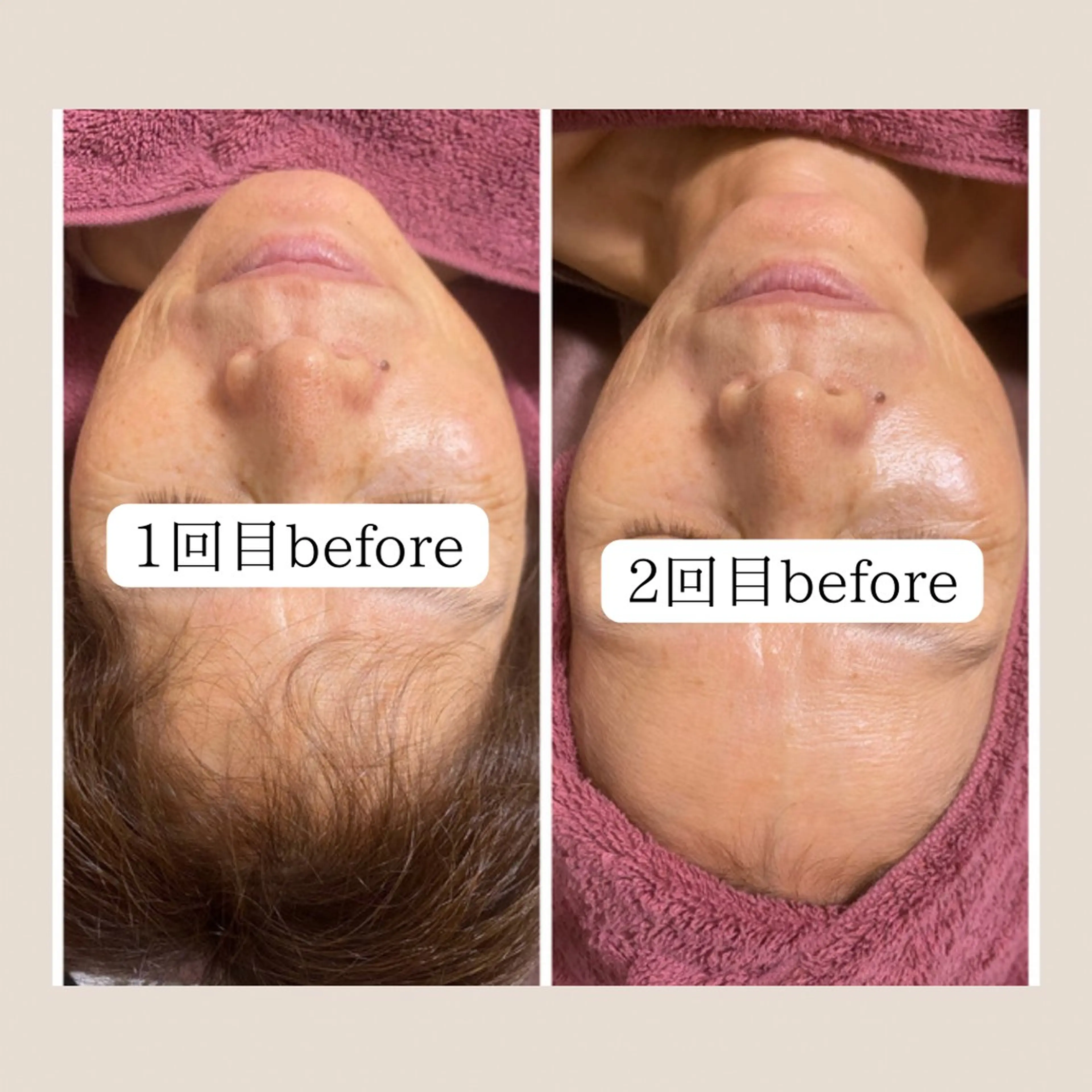 エステ 越猪 未来のネイルデザイン