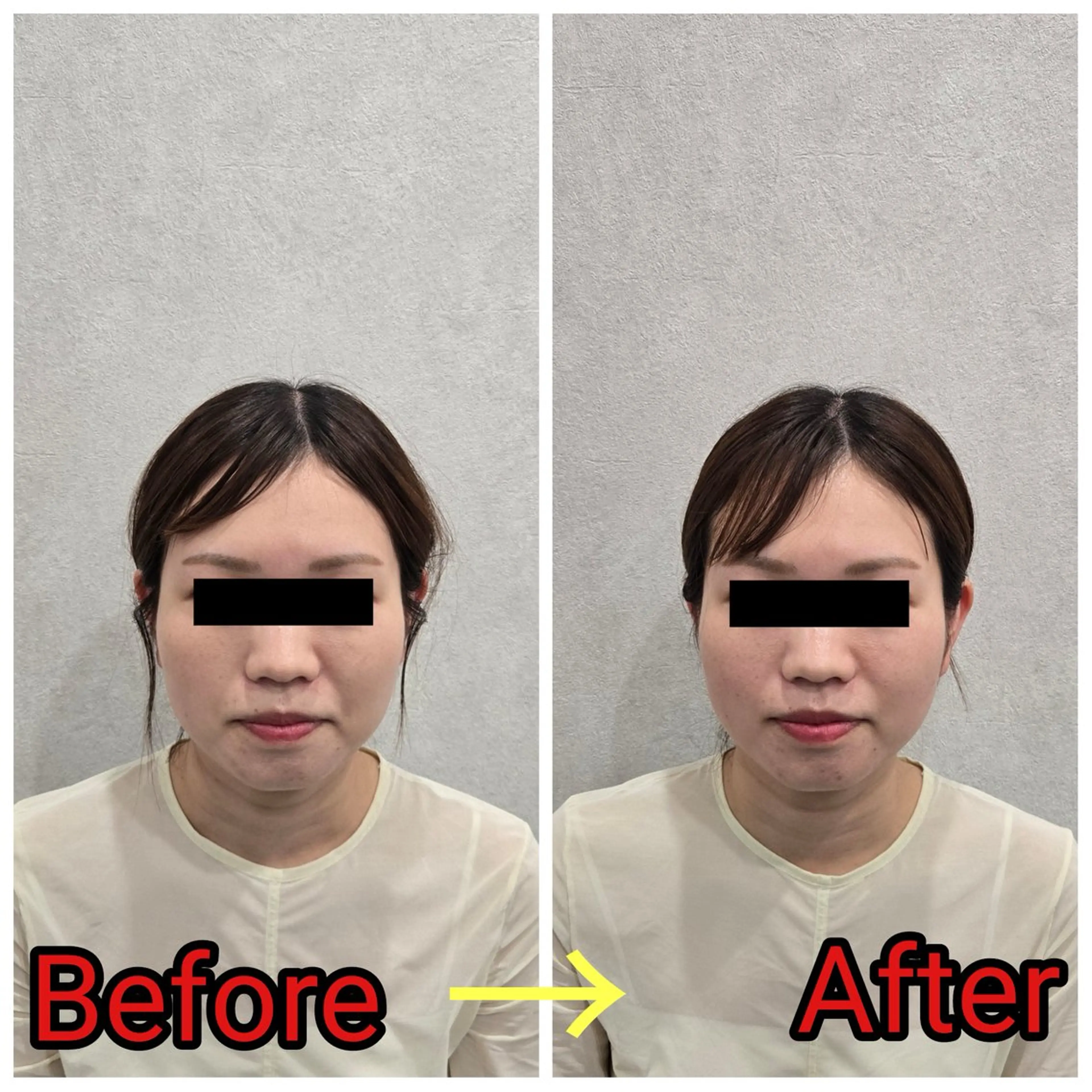 エステ リラク 小顔矯正・美容鍼 FLOW鍼灸整体院のエステ・リラクイメージ