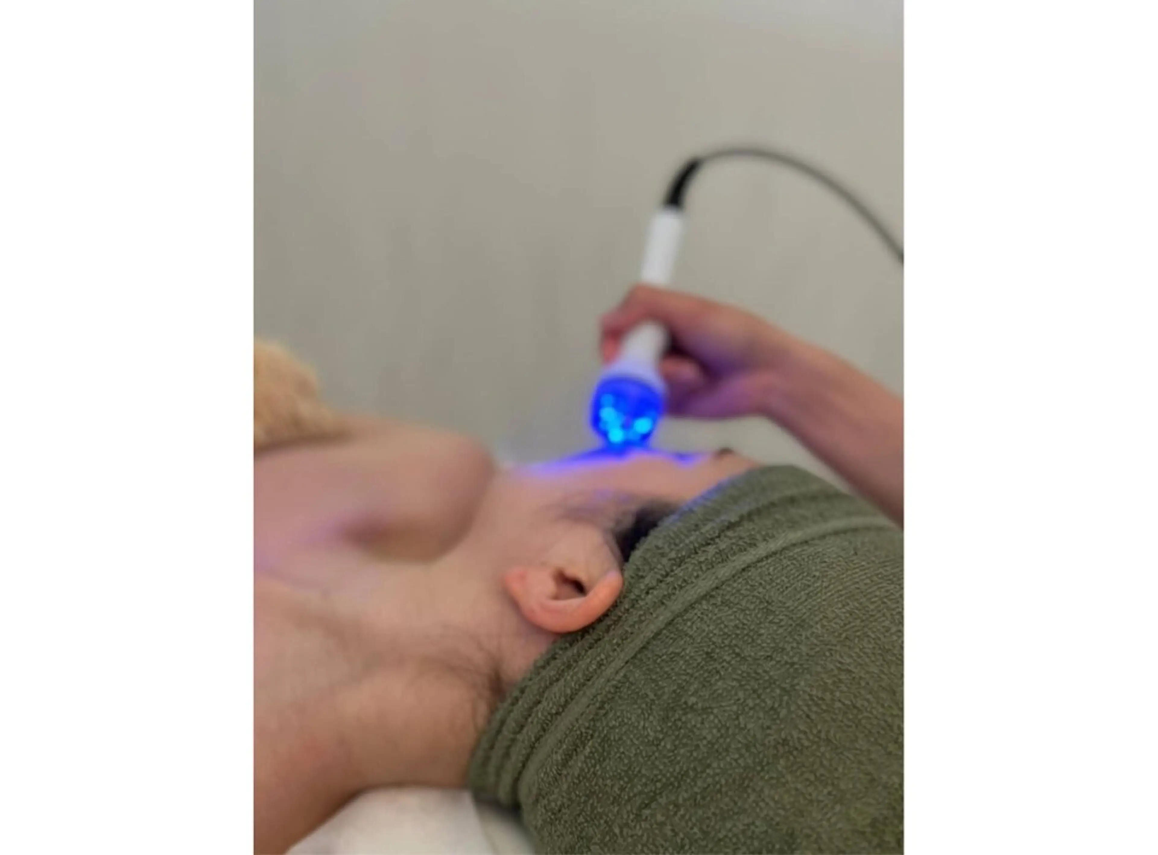 【モニター限定3名様】リフトアップだけでなく美肌ケアにも🎶ハイパーナイフEXお顔💆‍♀️ ⚠️口コミ必須の写真