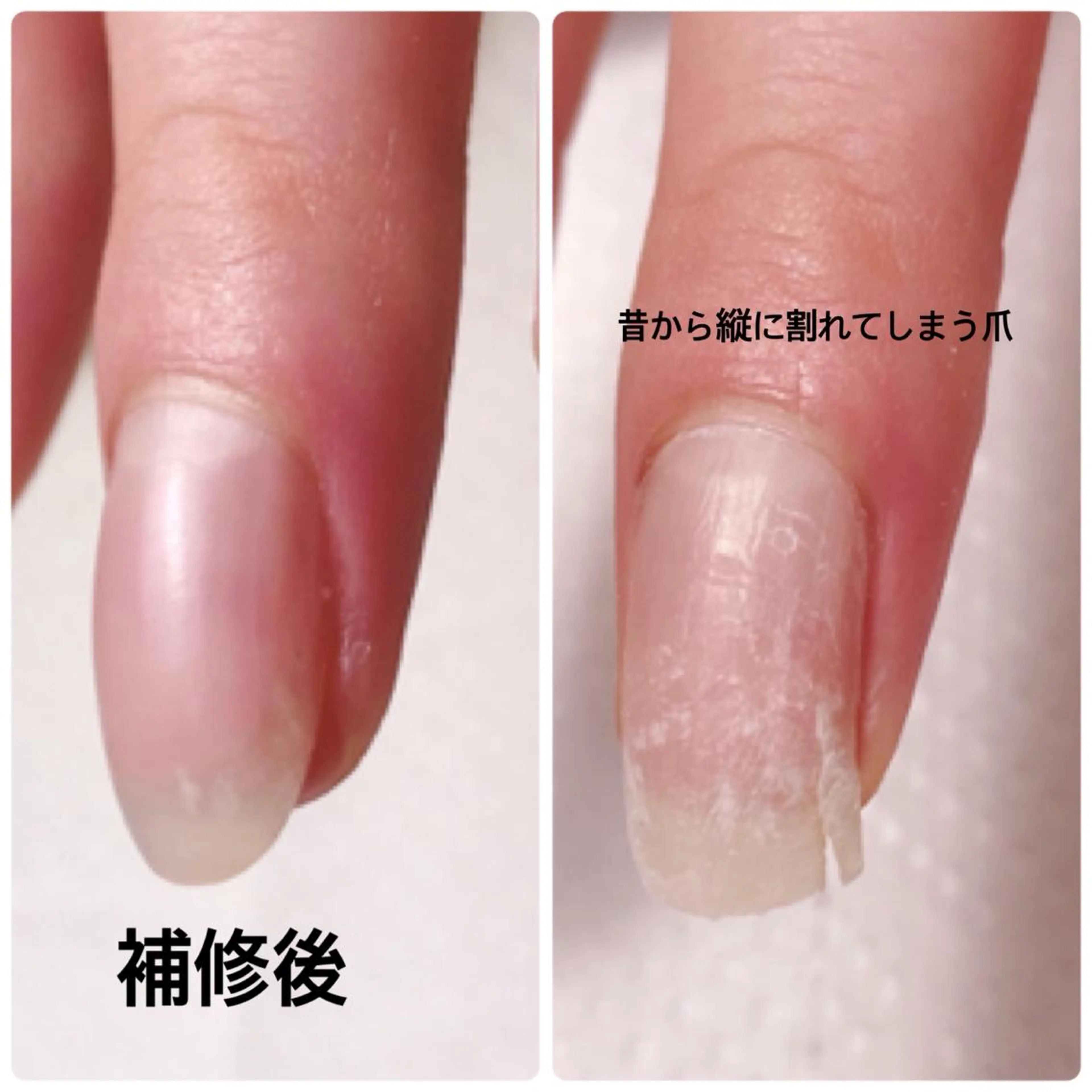 ネイル ハンドネイル 深爪を断らない スカルプ高評価店のネイルデザイン