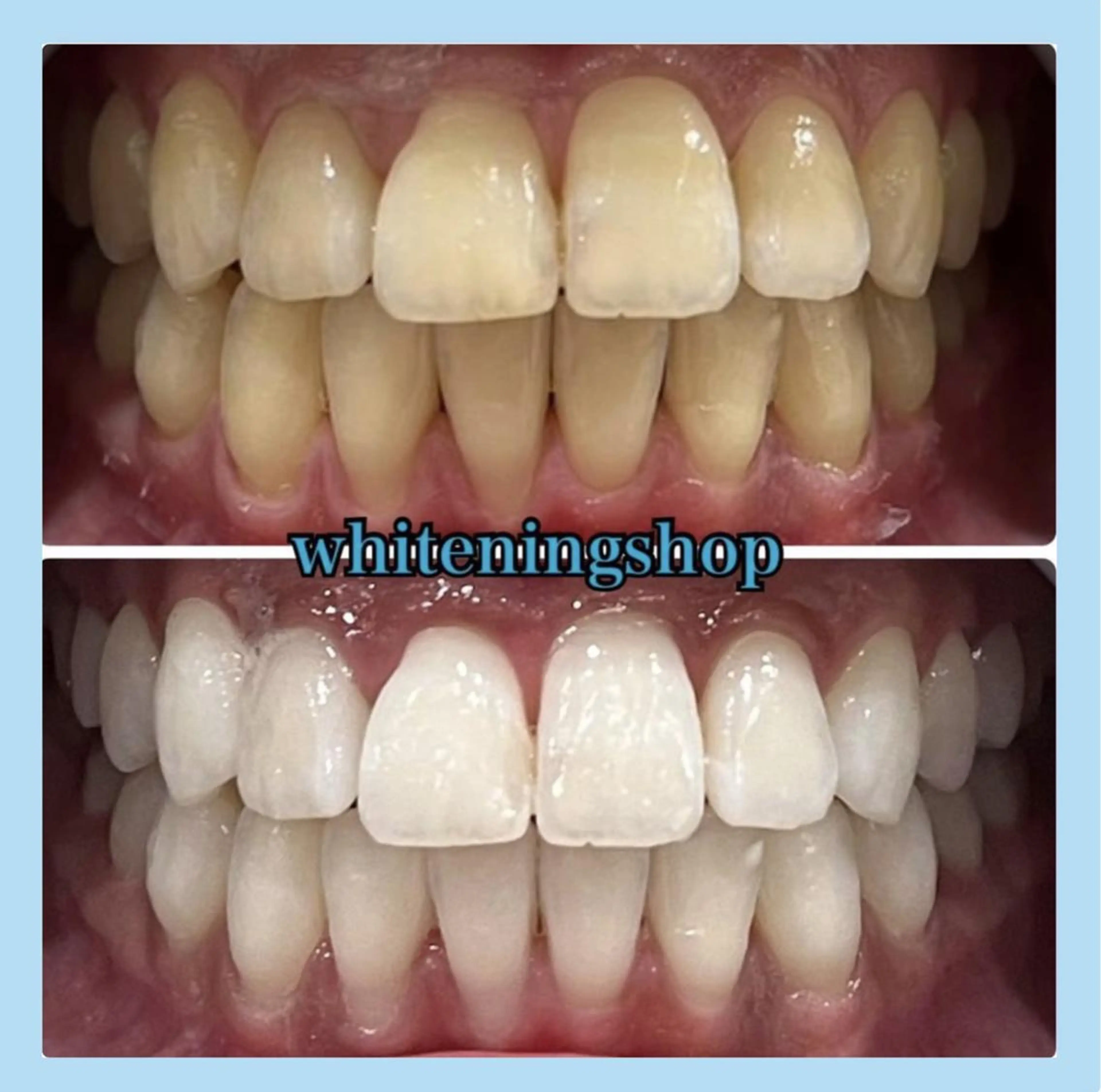 ホワイトニング ショップ千葉店のその他イメージ