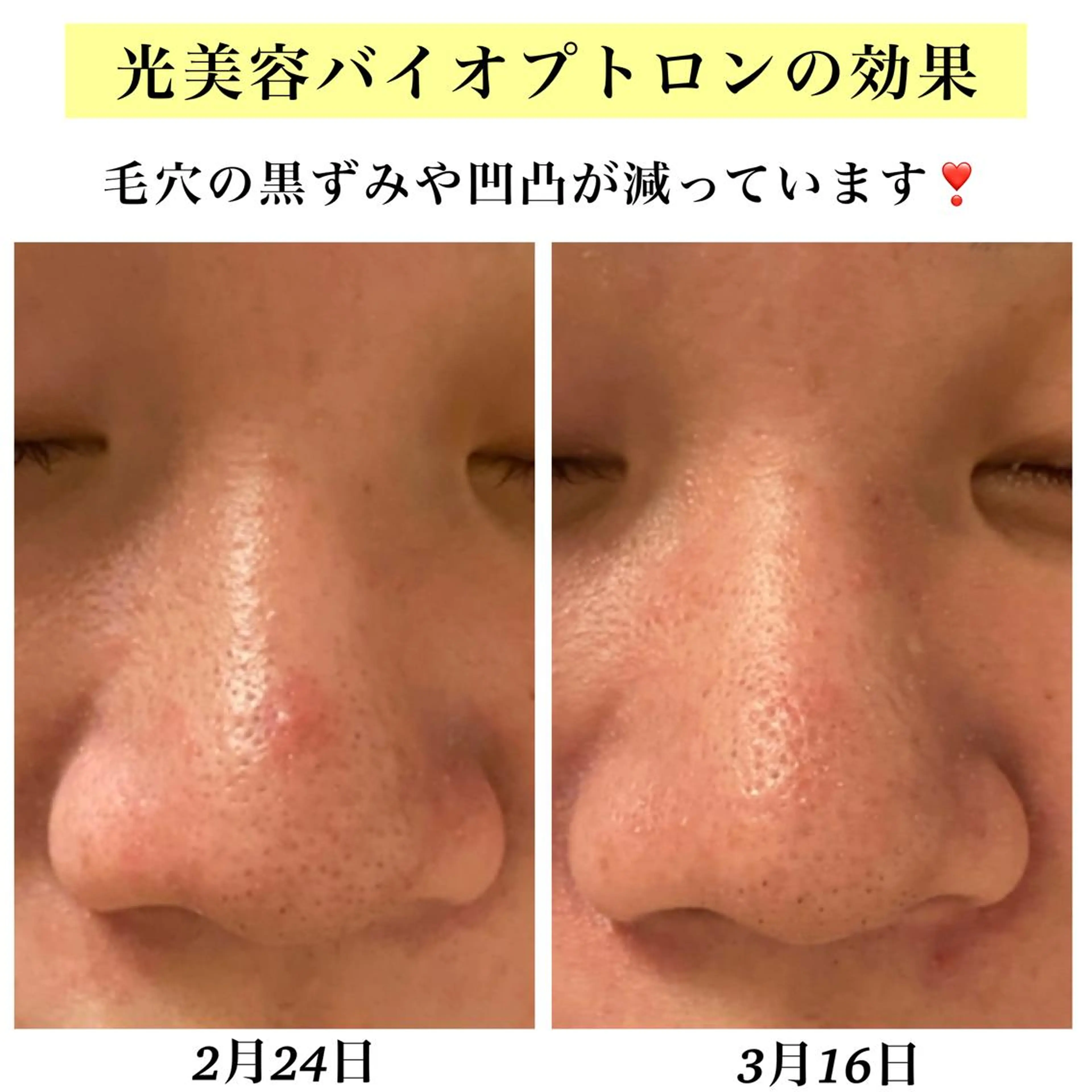 エステ リラク Bellesthe (ベルエステ)のエステ・リラクイメージ