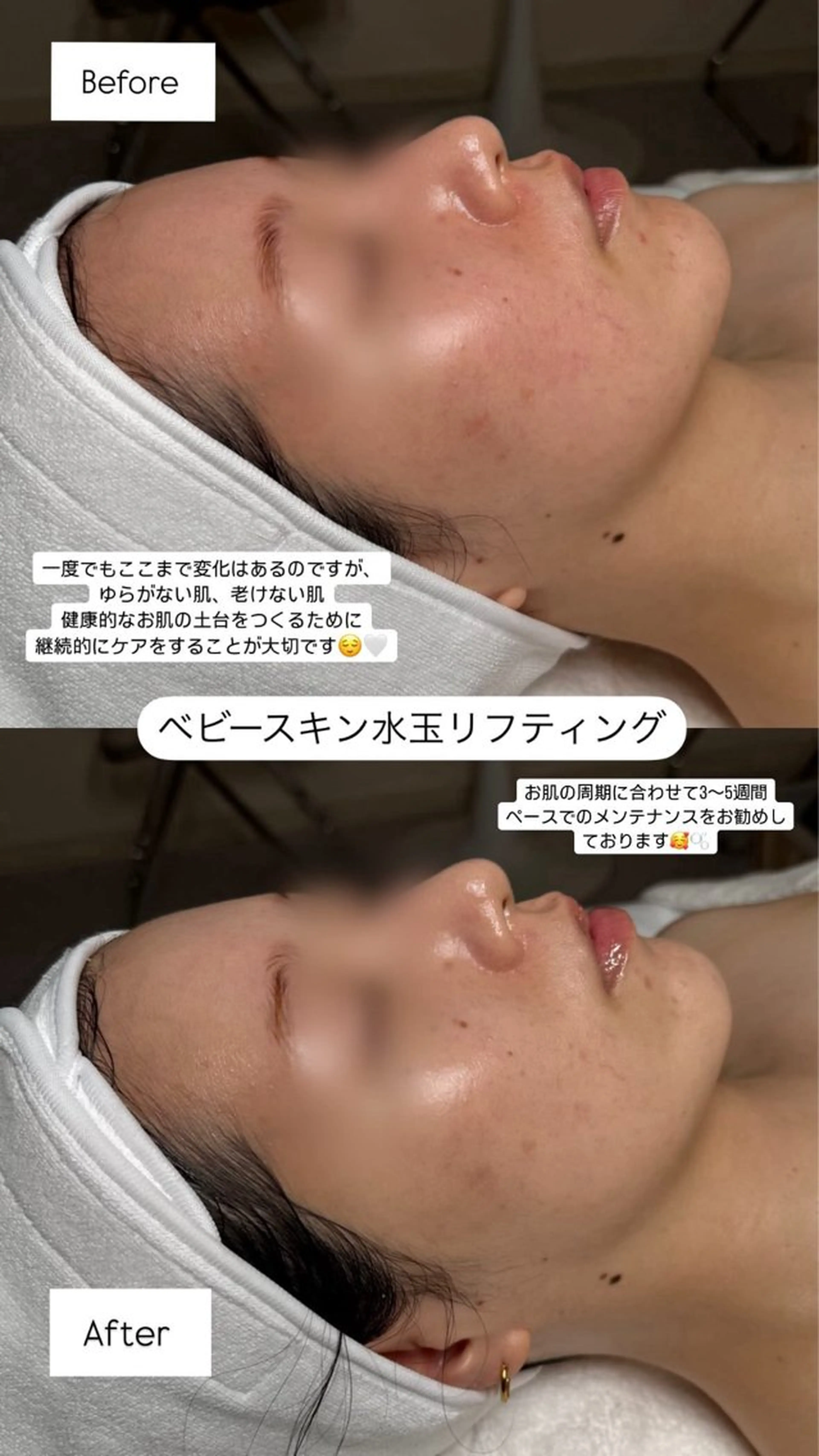 韓国肌管理🫧LDM 🫧Junnaのエステ・リラクイメージ