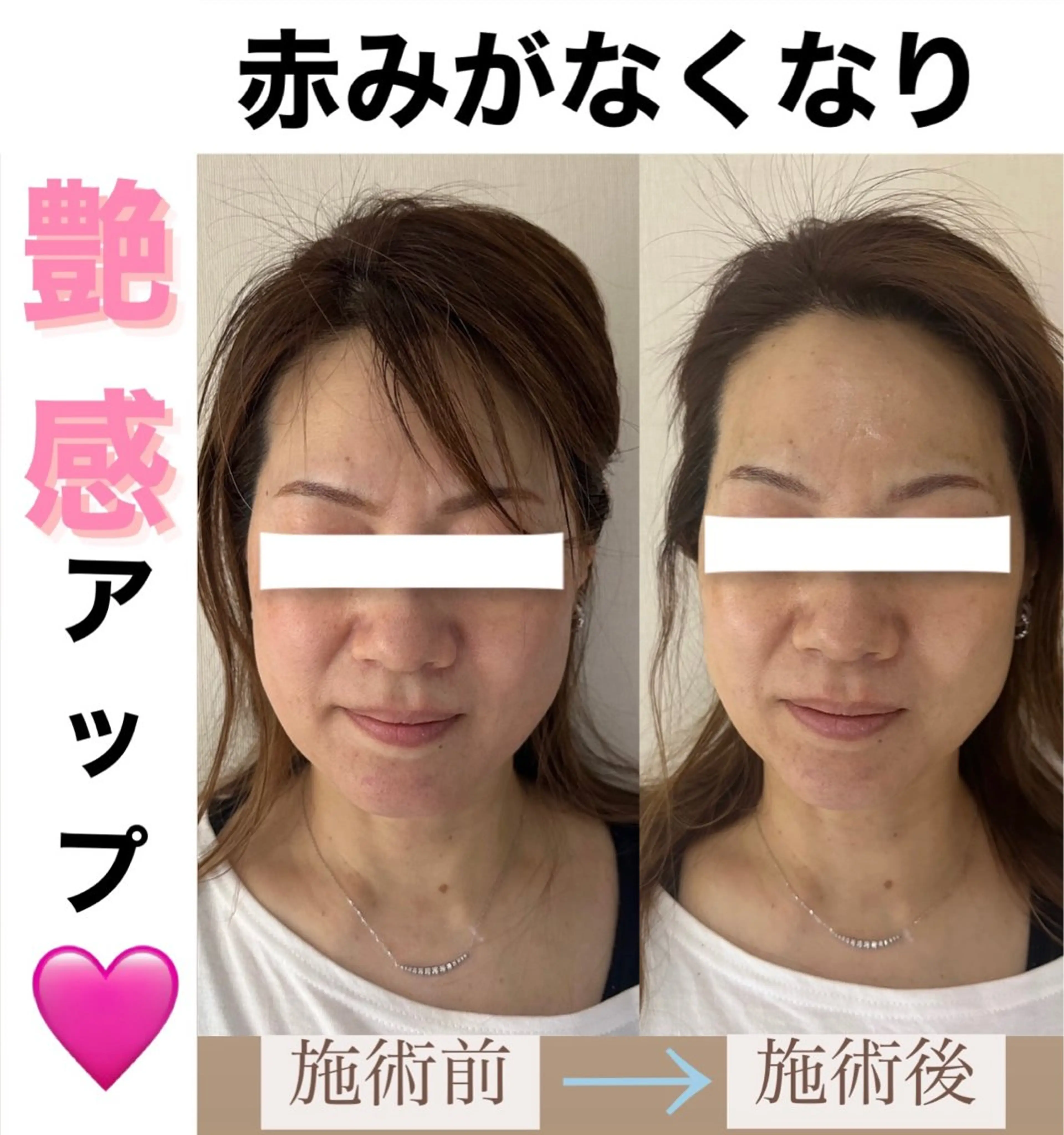 脱毛&美容サロンBLUESEA所属・脱毛&美容サロン BLUESEAのエステ・リラクイメージ