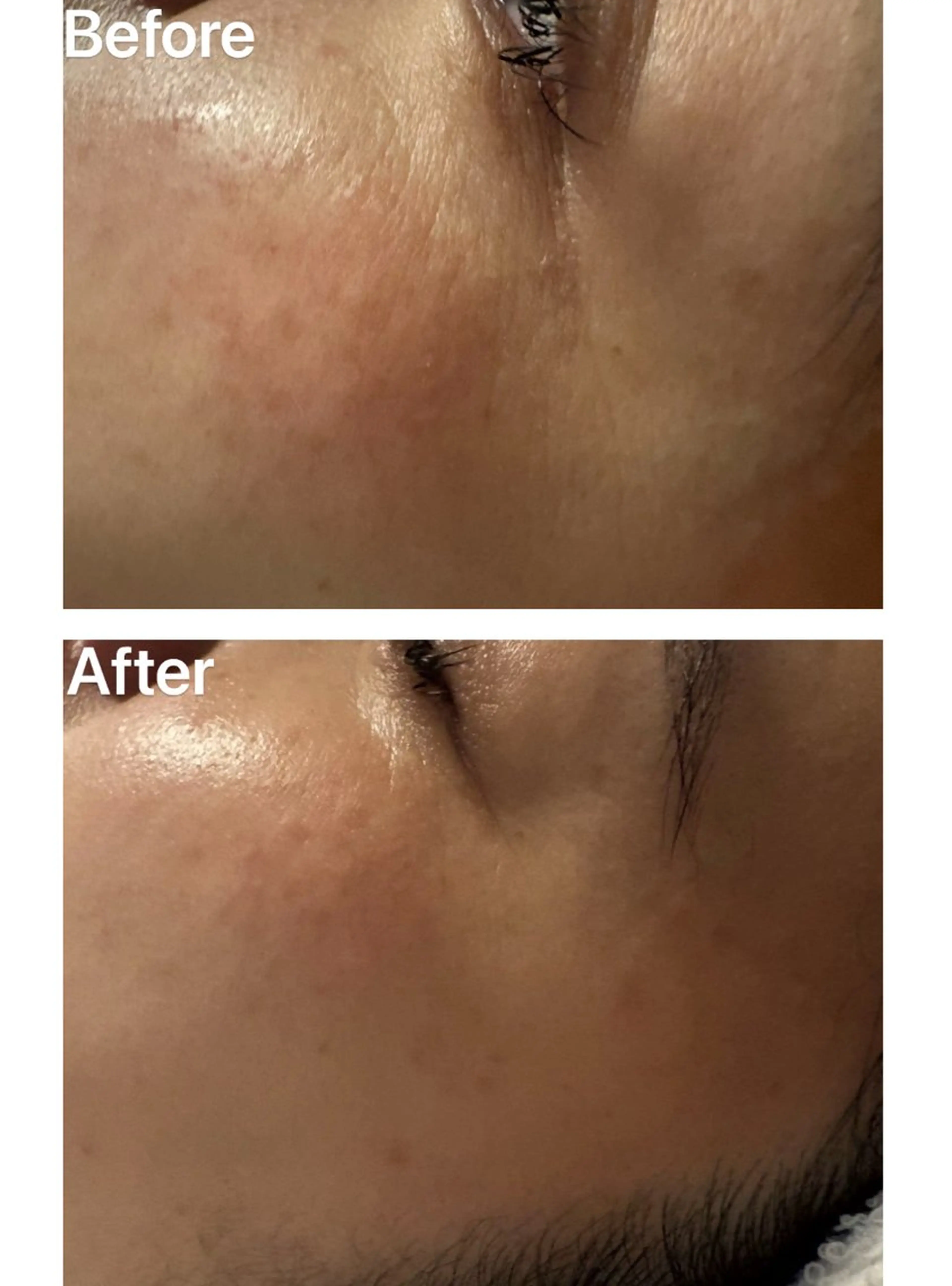 トータルビューティー サロン・Ｎの眉毛・アイブロウイメージ