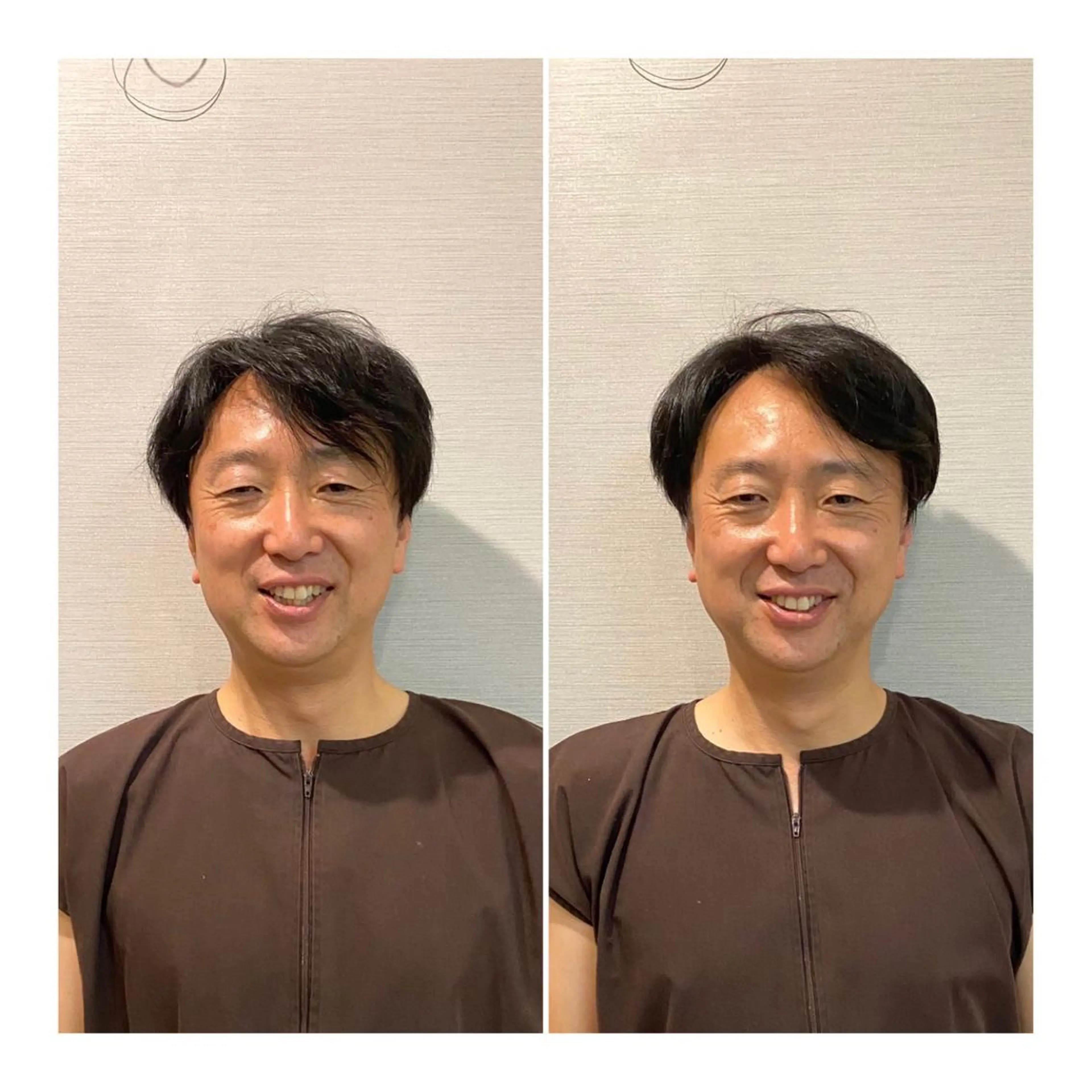 メンズ 即小顔♥️美容鍼× ハーブピーリングのその他イメージ