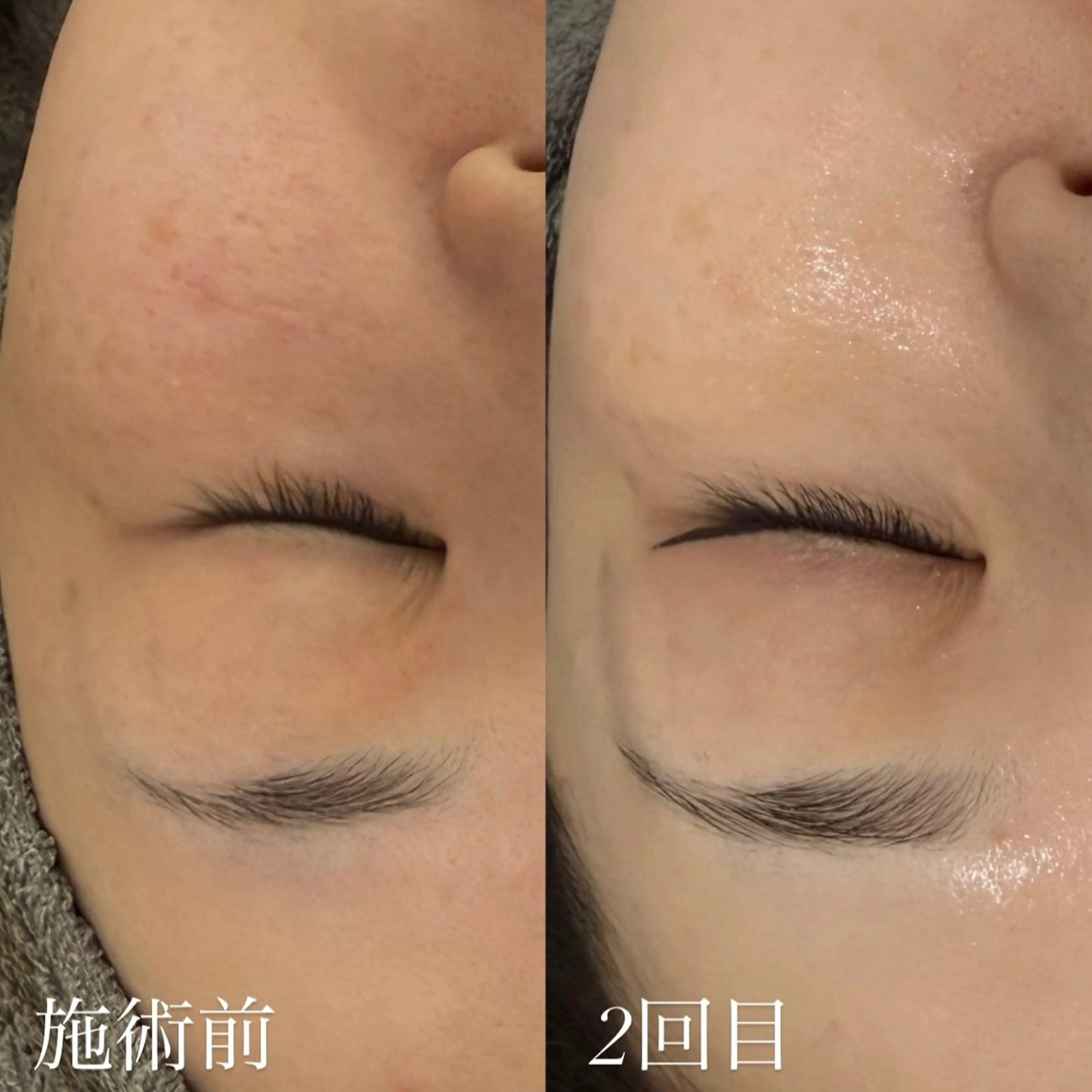 Froom sayaのエステ・リラクイメージ