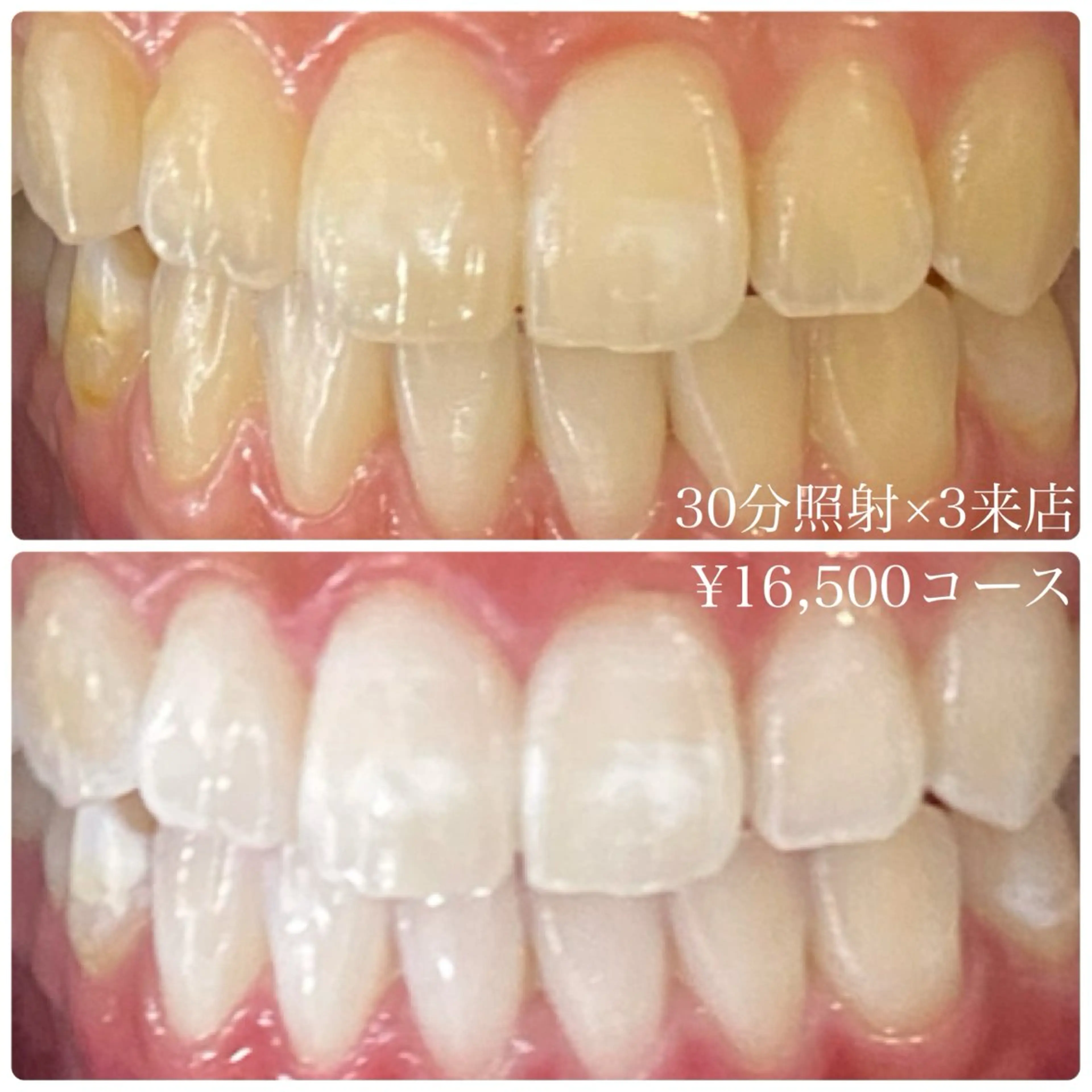 メンズ その他 ホワイトニングルーム　川崎店所属・ホワイトニング ルーム　川崎店のその他イメージ