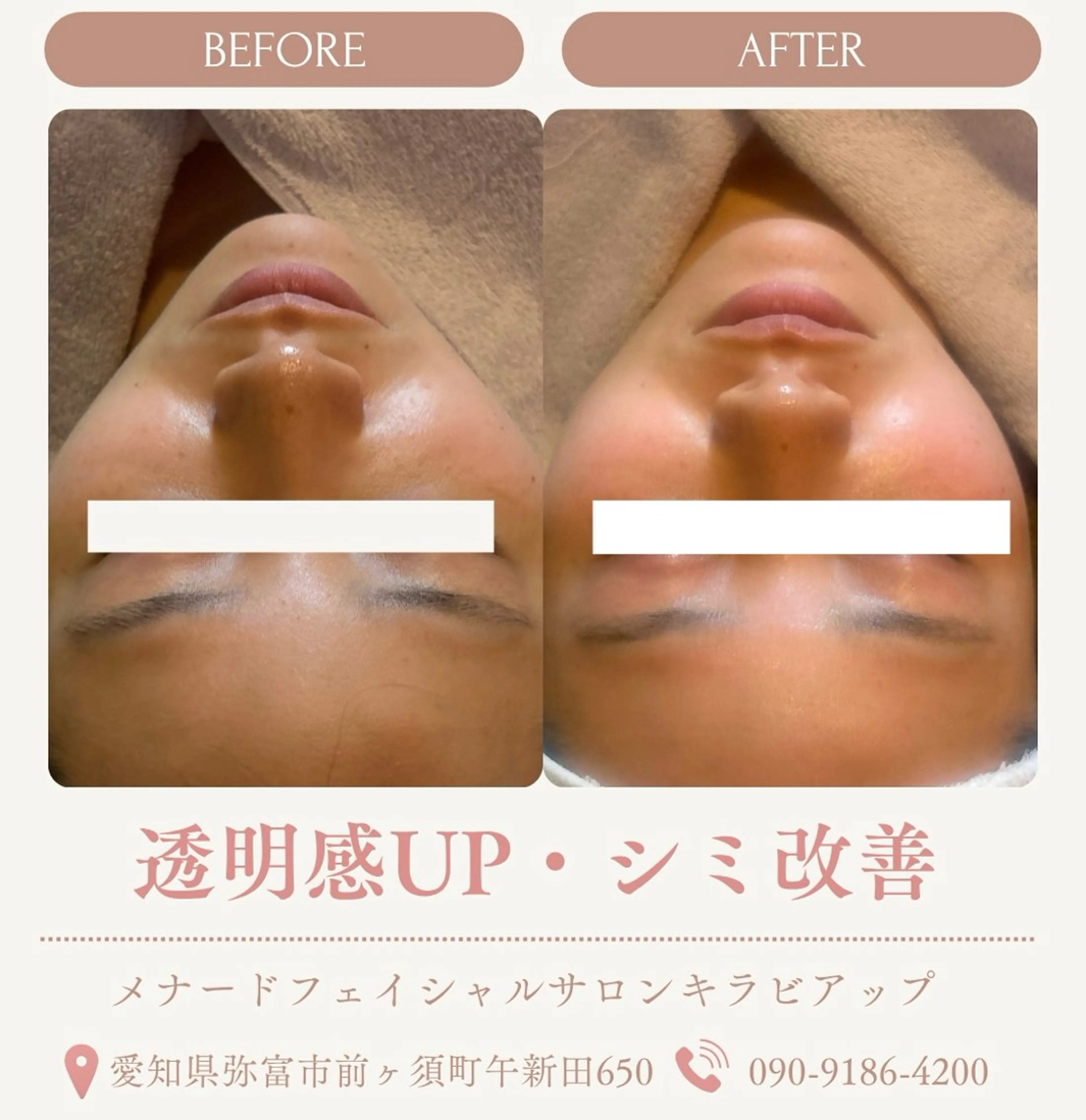メナードフェイシャルサロンキラビアップ所属・肌改善・美肌サポート 🤍tokoのエステ・リラクイメージ