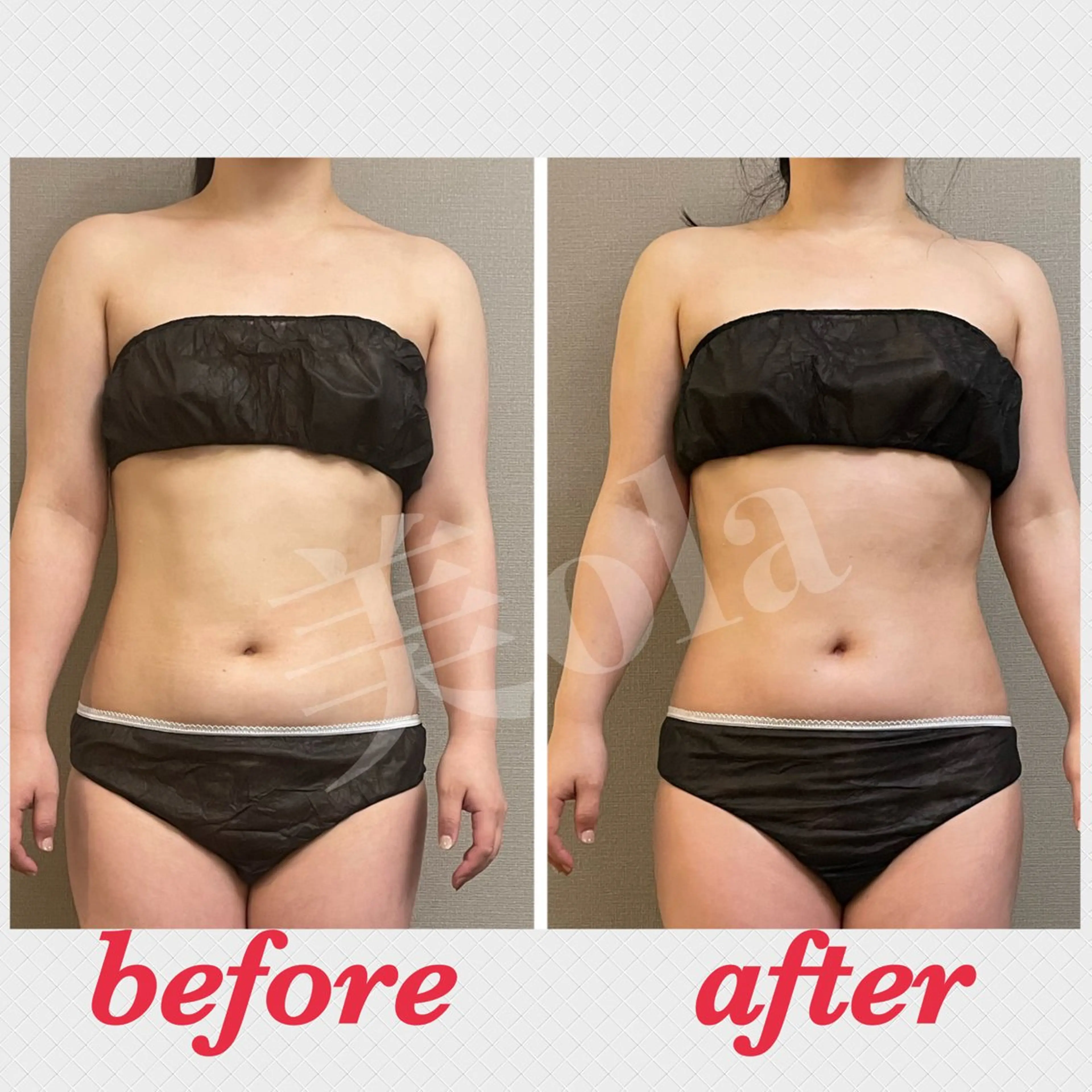 エステ リラク 美ola ビオラのエステ・リラクイメージ