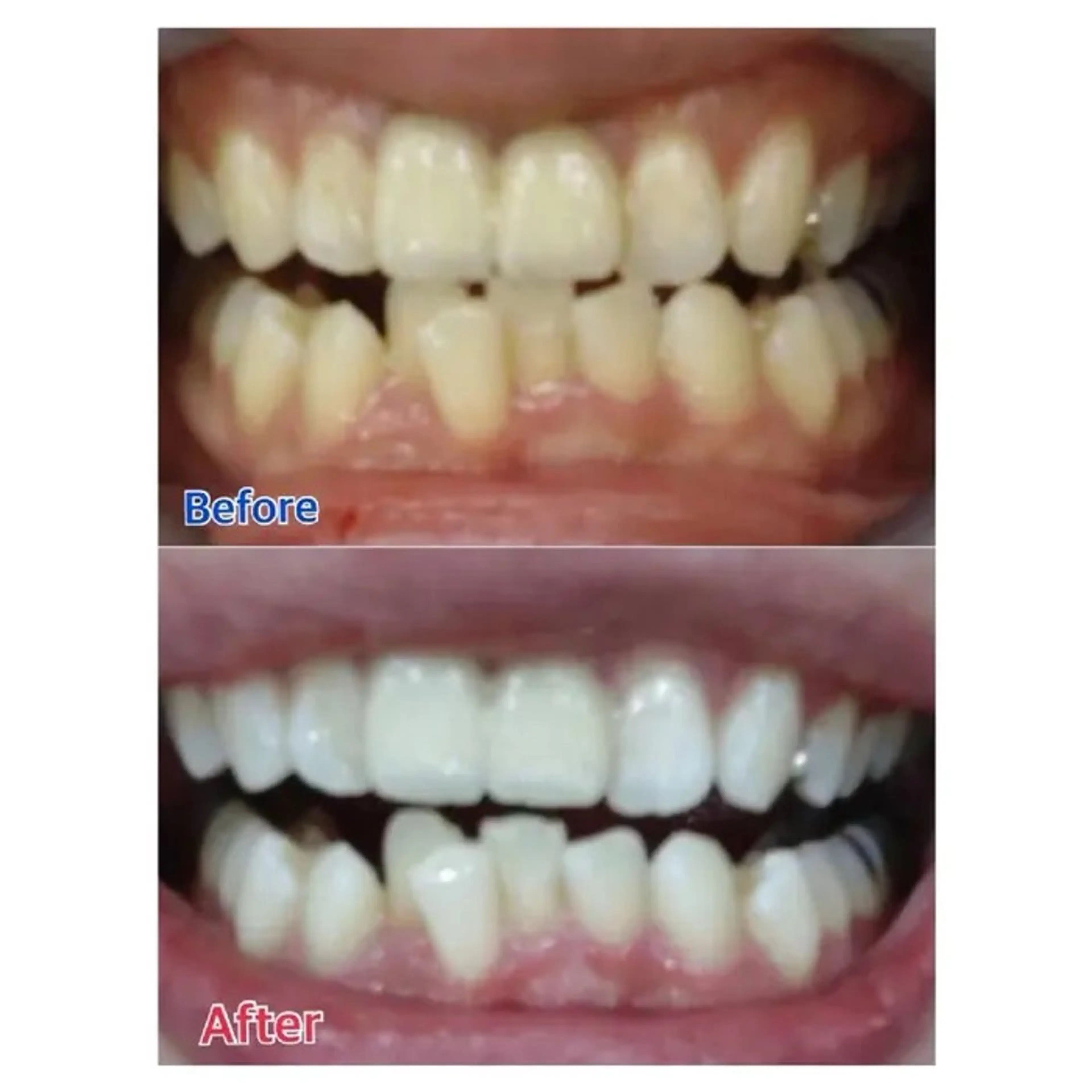 M渋谷店所属・M渋谷 ホワイトニングのその他イメージ