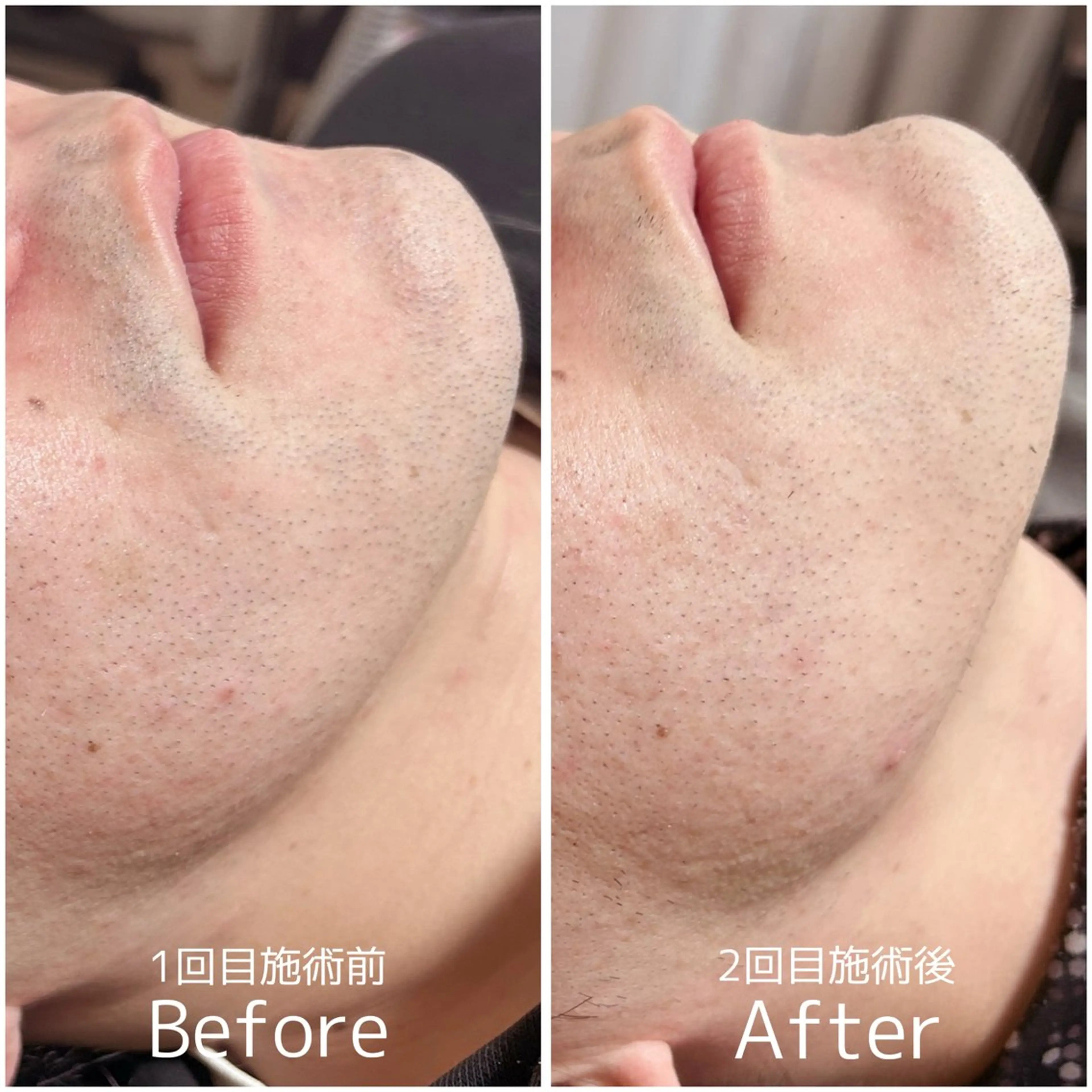 宮代・脱毛サロンMIIN所属・地域最安値の脱毛と 韓国美容【MIIN】のエステ・リラクイメージ