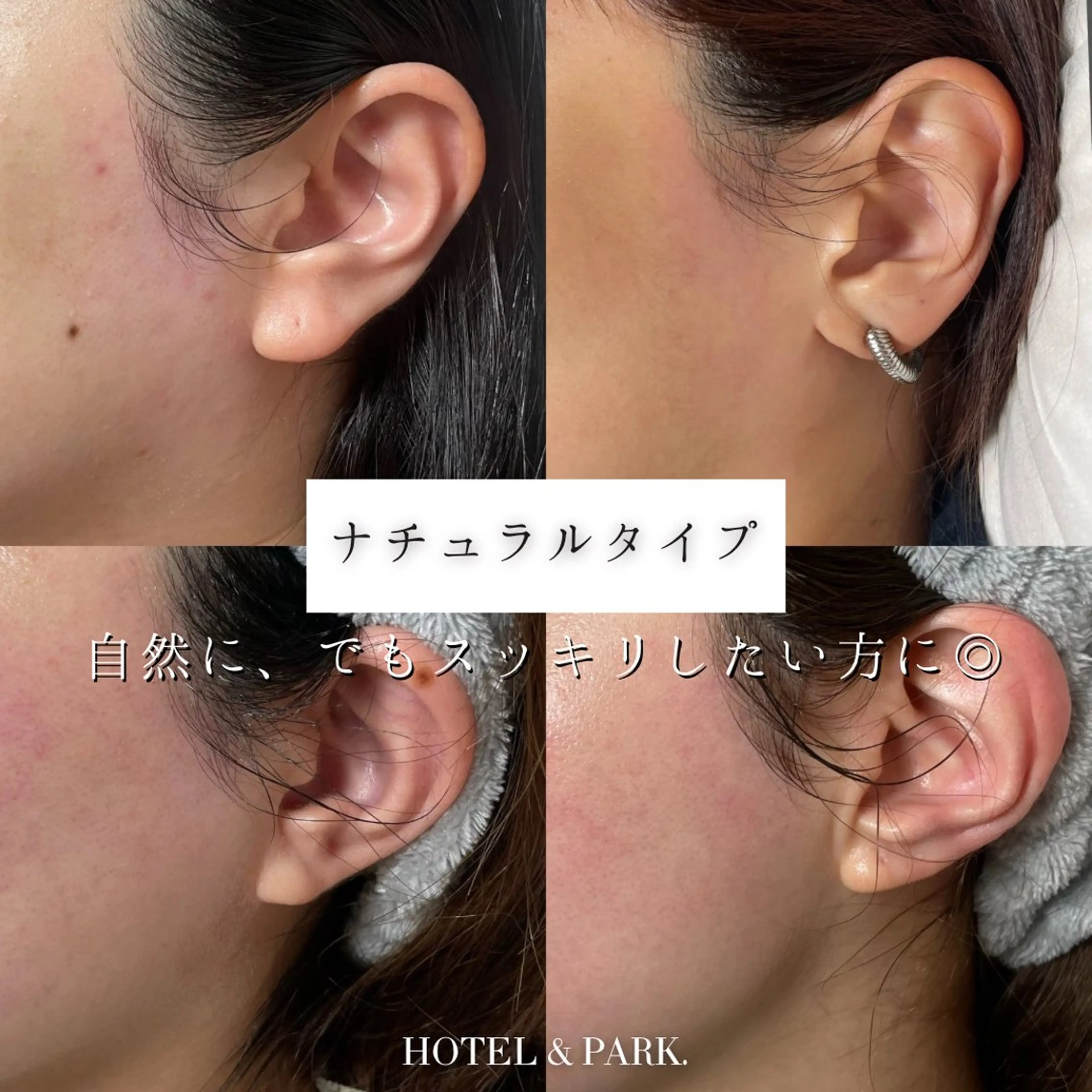 脱毛 HOTEL&PARK . ワックス脱毛のエステ・リラクイメージ