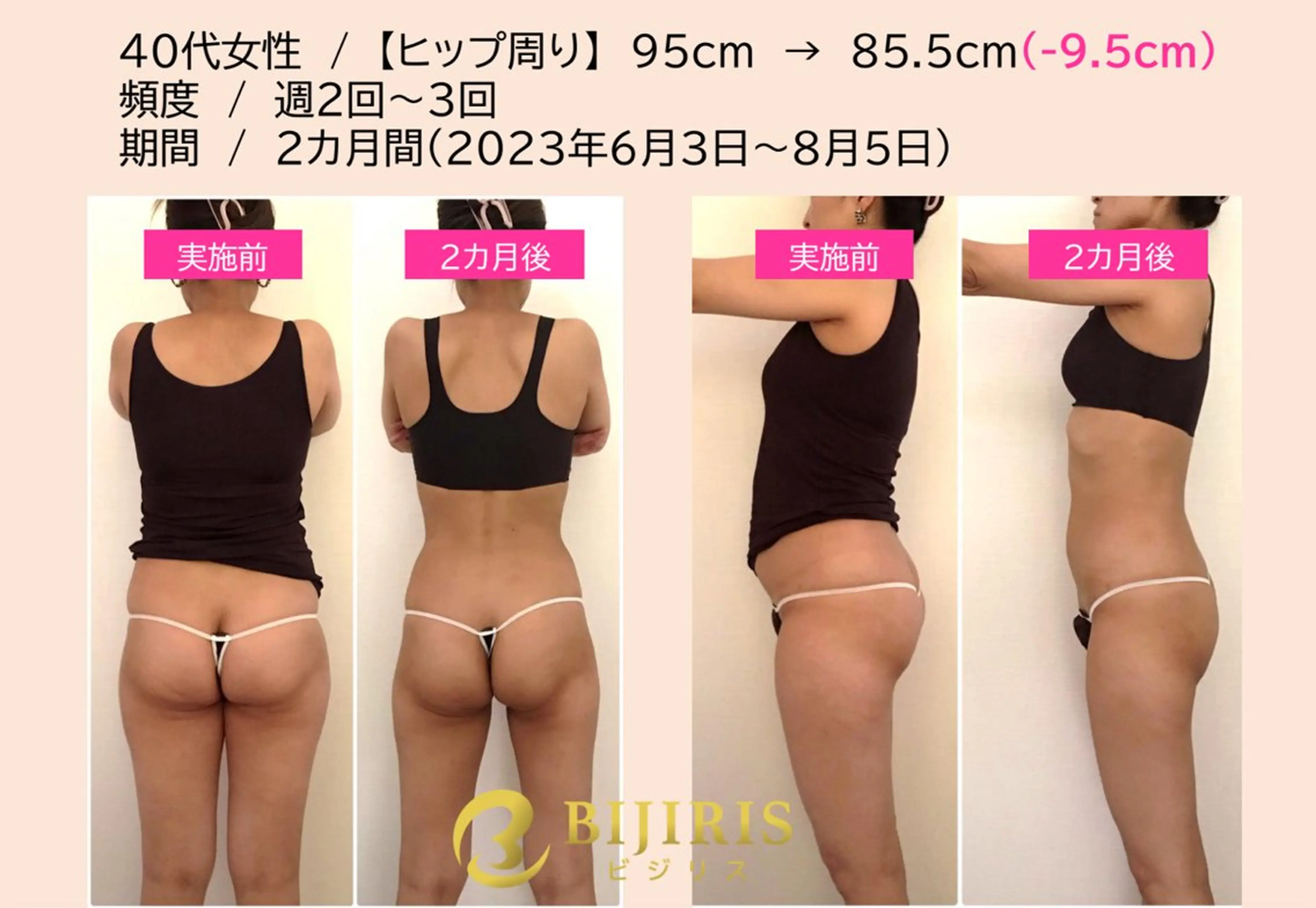 セルフ脱毛/美尻イス キングスサロン熊本のエステ・リラクイメージ