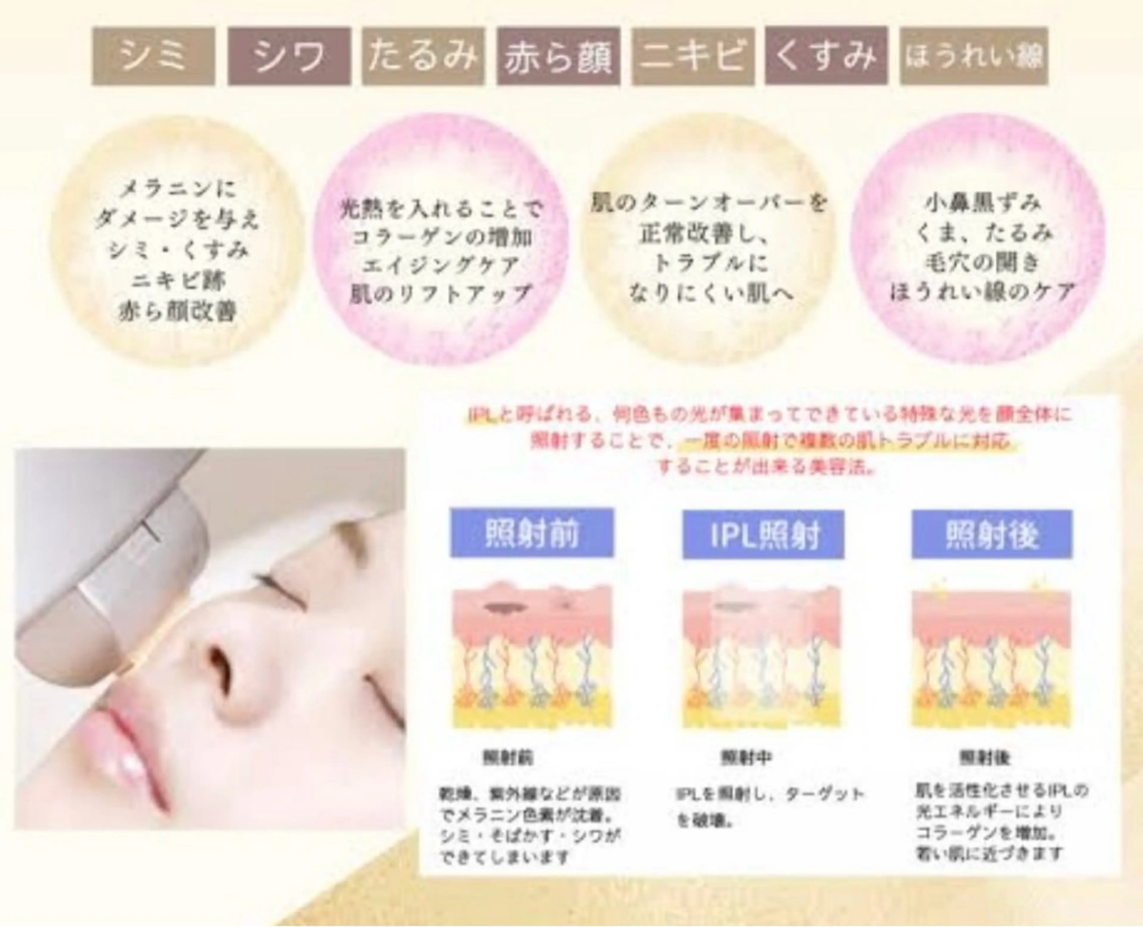 salonvilla所属・villa ☺︎草山 楓花のエステ・リラクイメージ