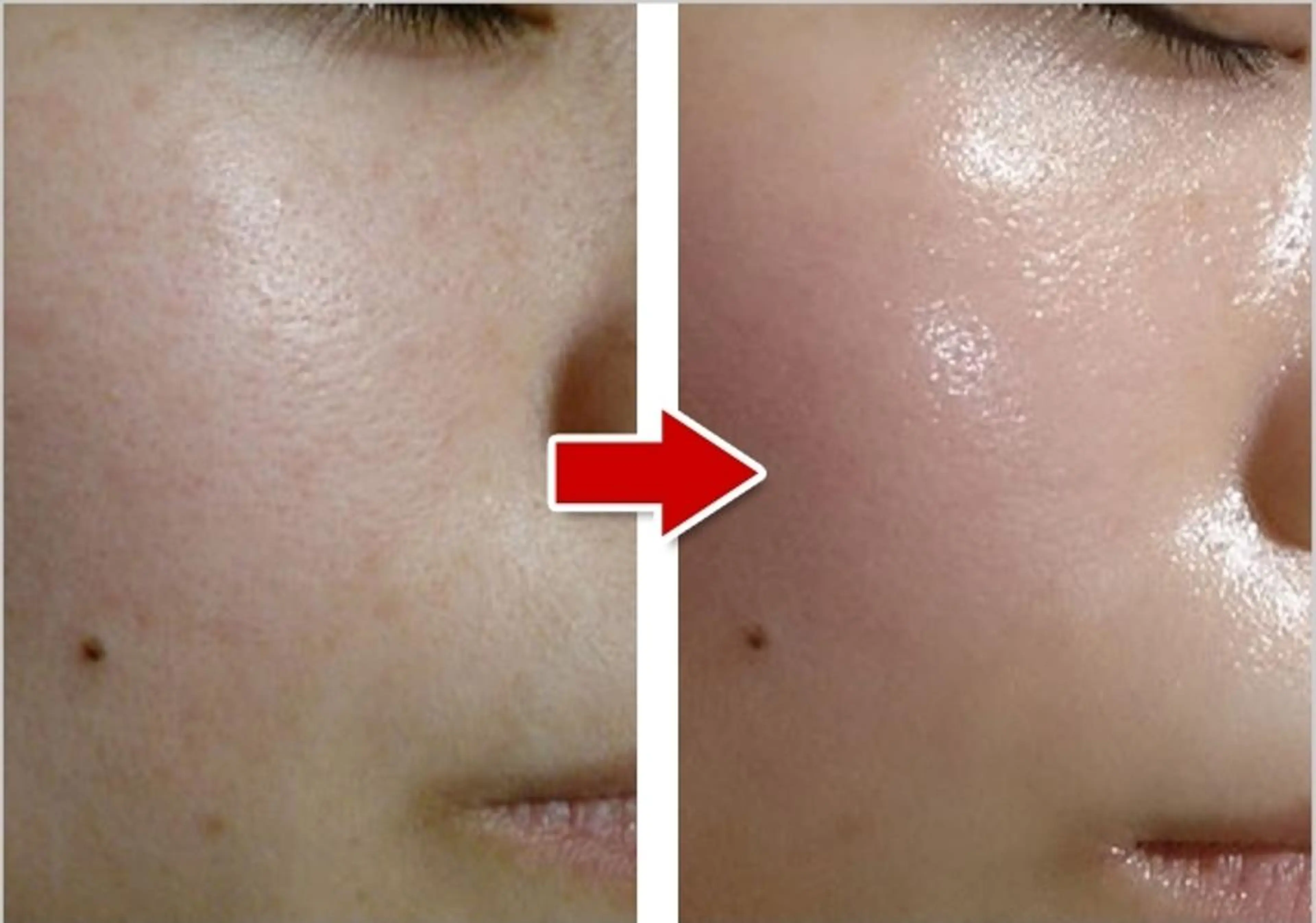 千葉中央/まつげ 大会日本一獲得のマツエク・マツパデザイン