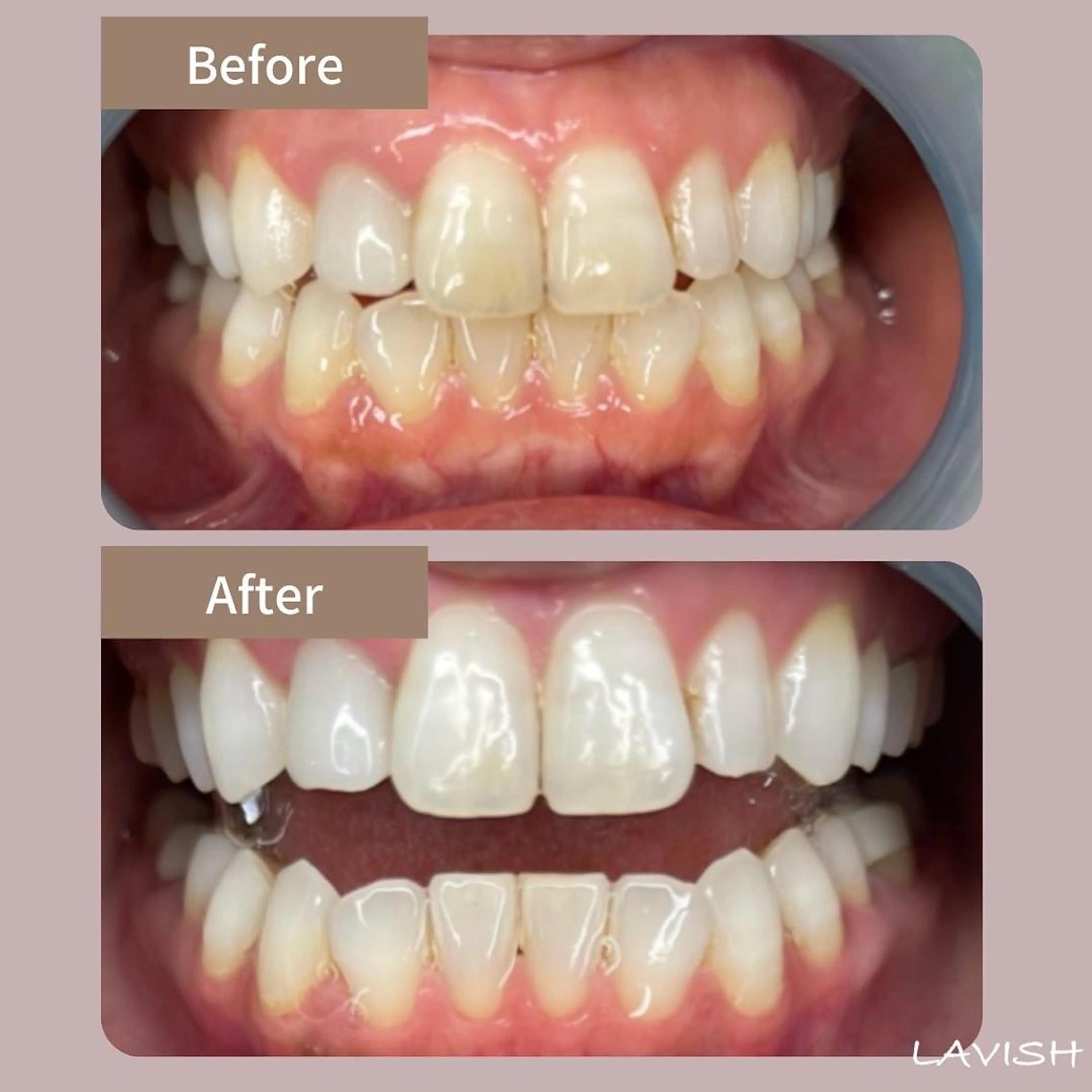 LAVISH nail salonのネイルデザイン