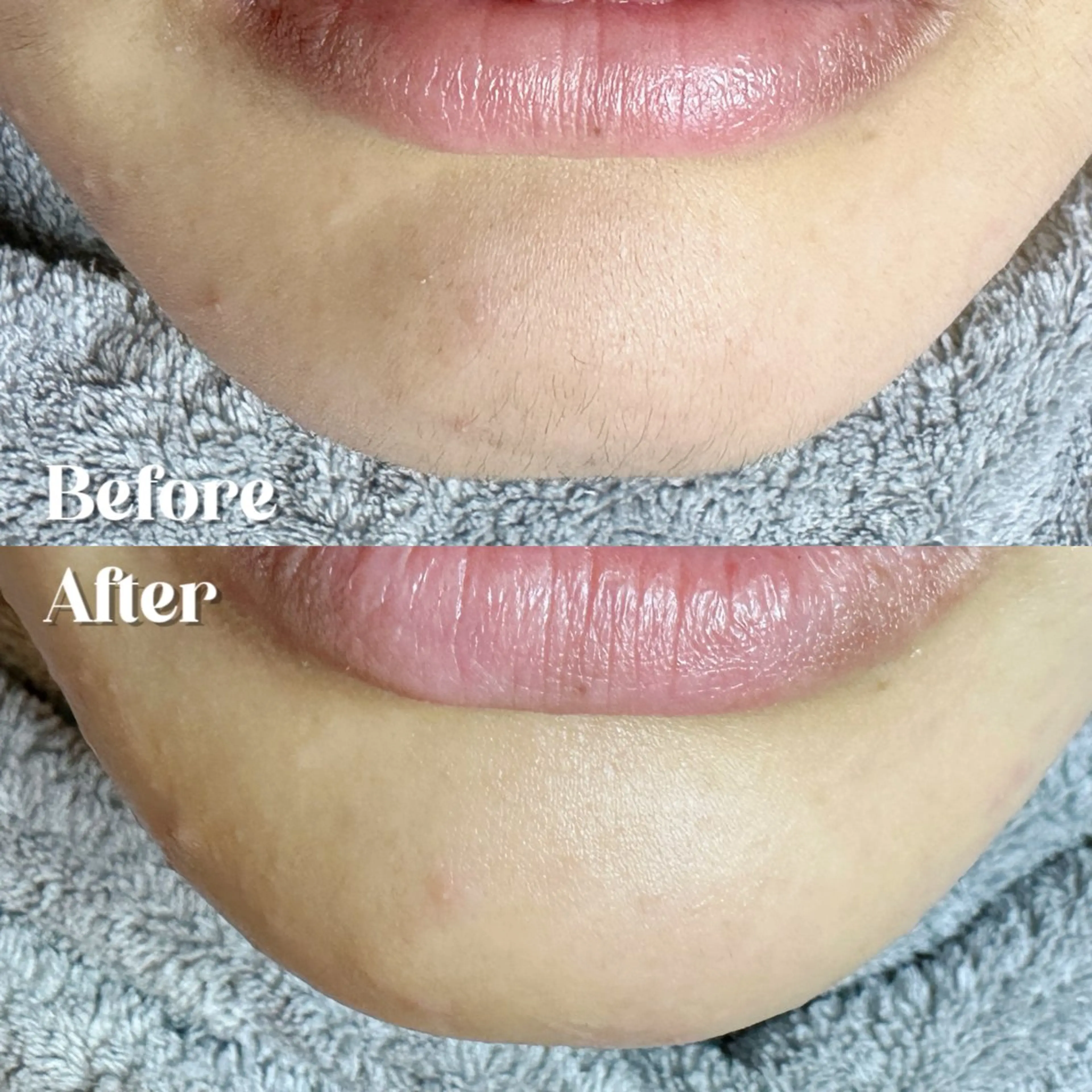 Hit. シュガーリング豊橋のエステ・リラクイメージ