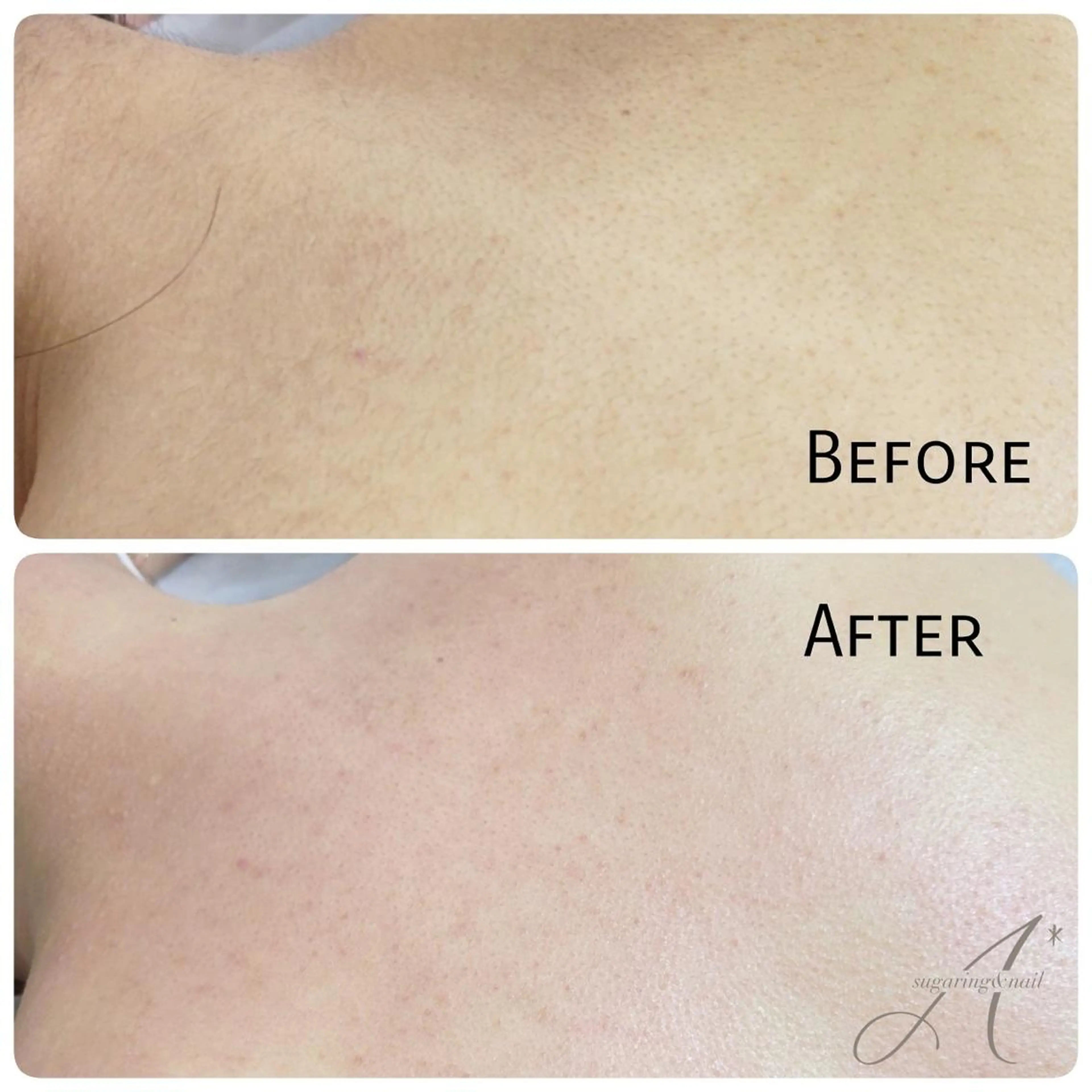 【A*エースター】 KARINのエステ・リラクイメージ