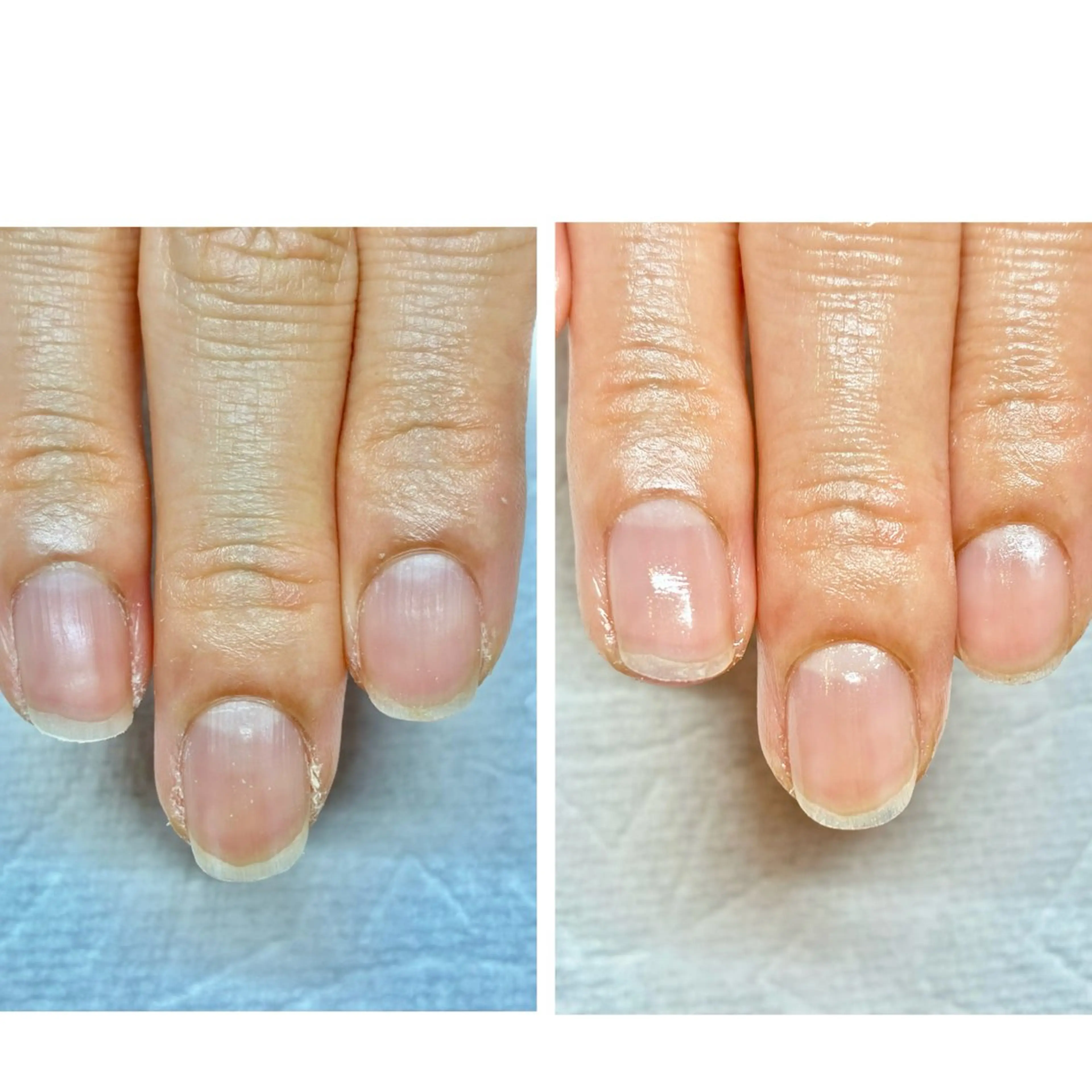 ネイル ハンドケア 鈴木 麻里のネイルデザイン