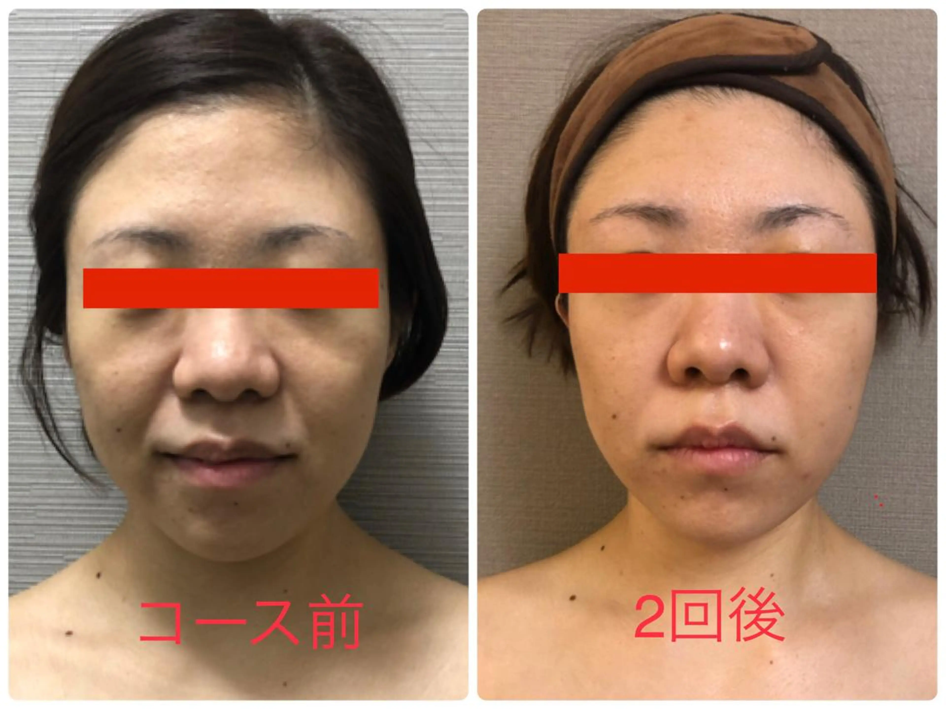 エステ 美ola ビオラのエステ・リラクイメージ