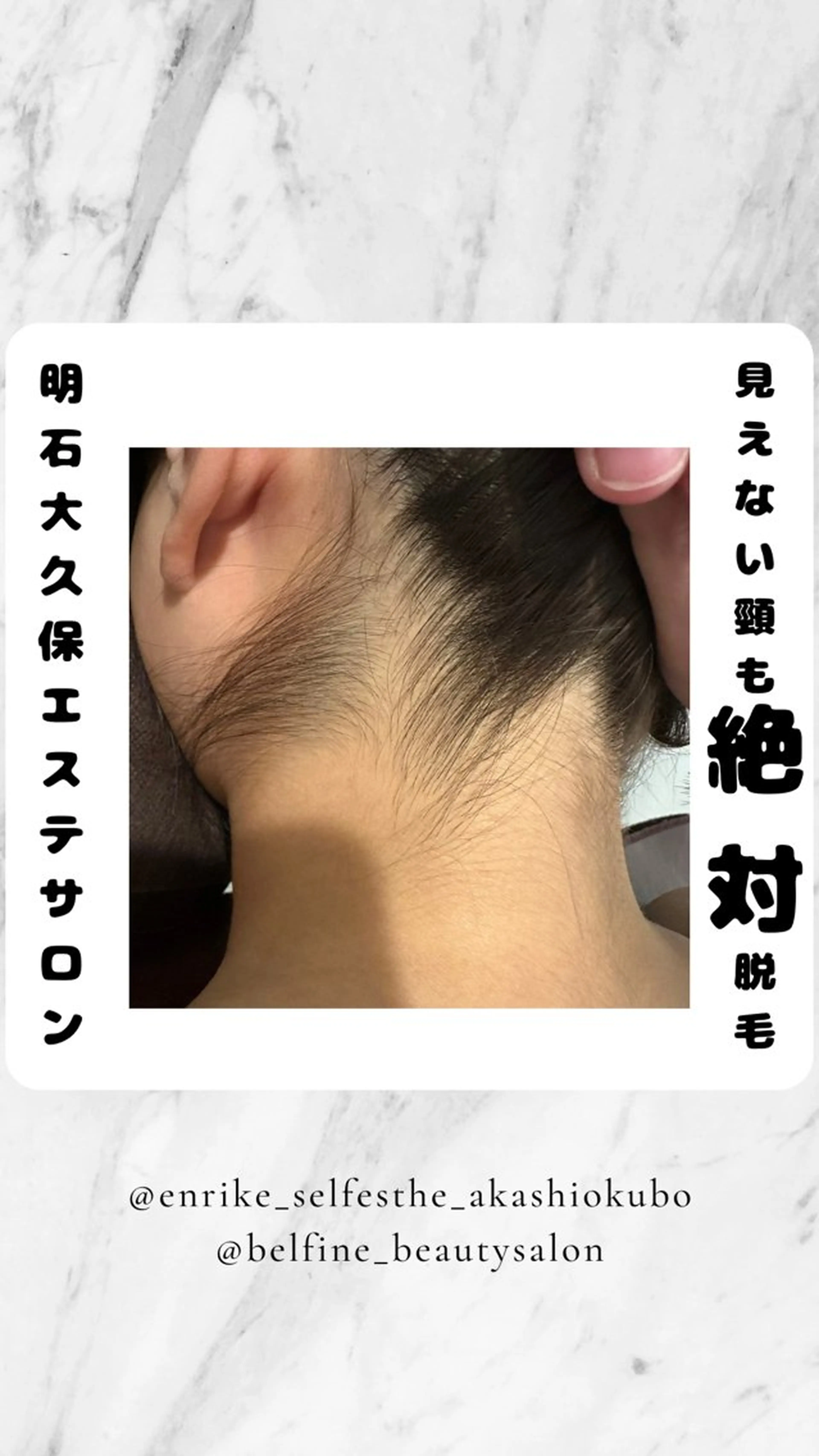 脱毛 セルフエステエンリケ明石大久保店所属・夕希リンパ&痩身& 脱毛&毛穴ケアのエステ・リラクイメージ