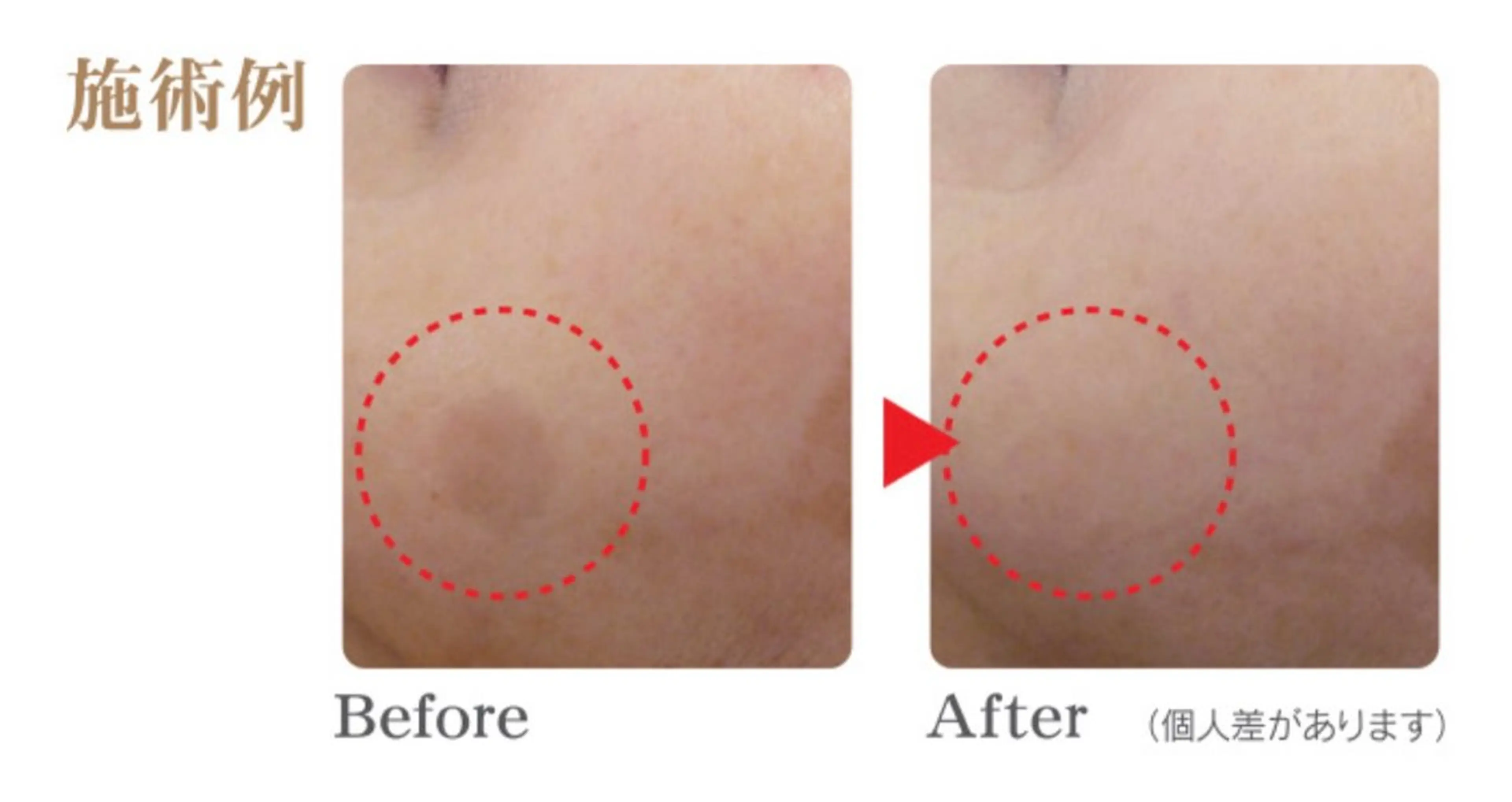 エステ シミケア Salon Mのエステ・リラクイメージ