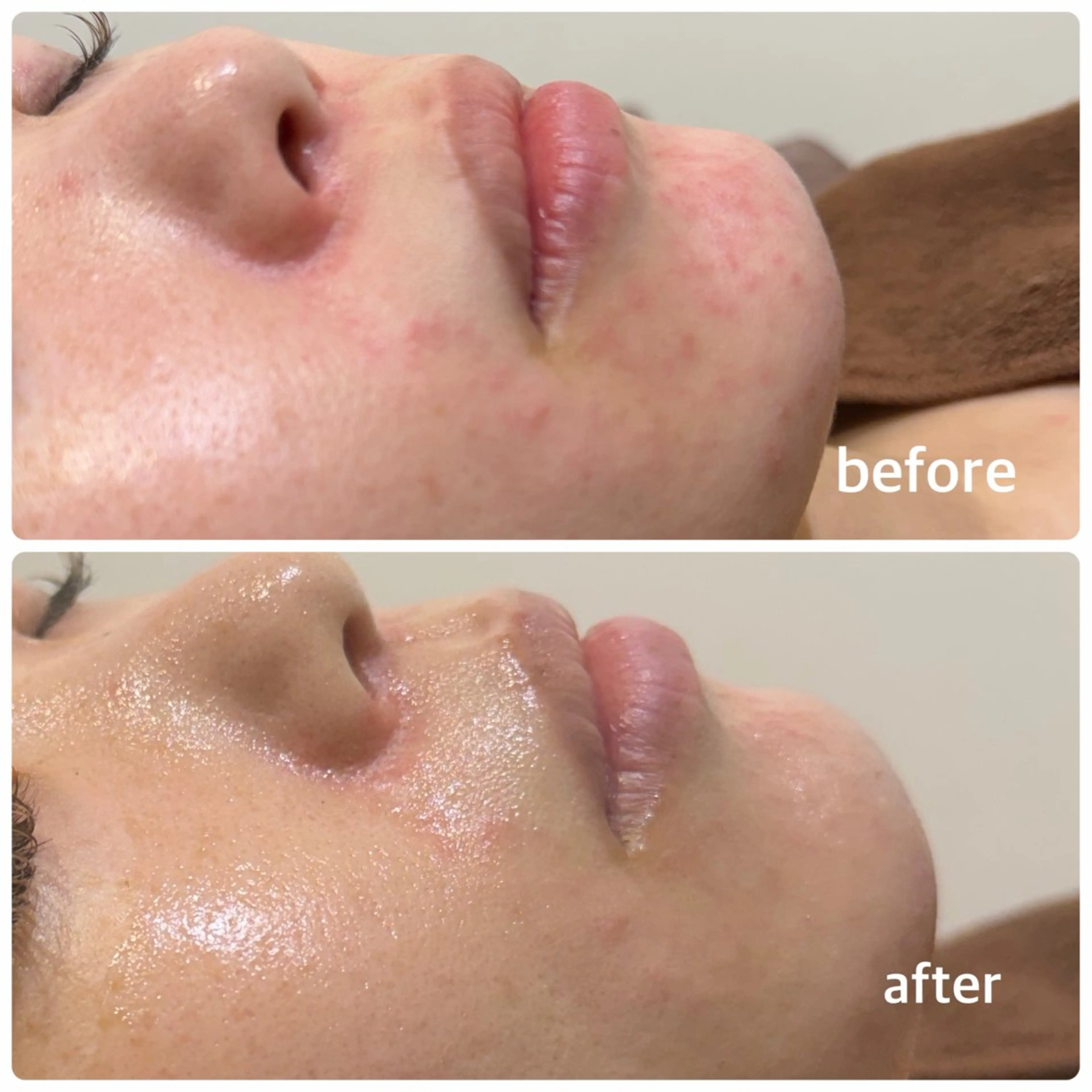 その他 今西 彩夢のエステ・リラクイメージ