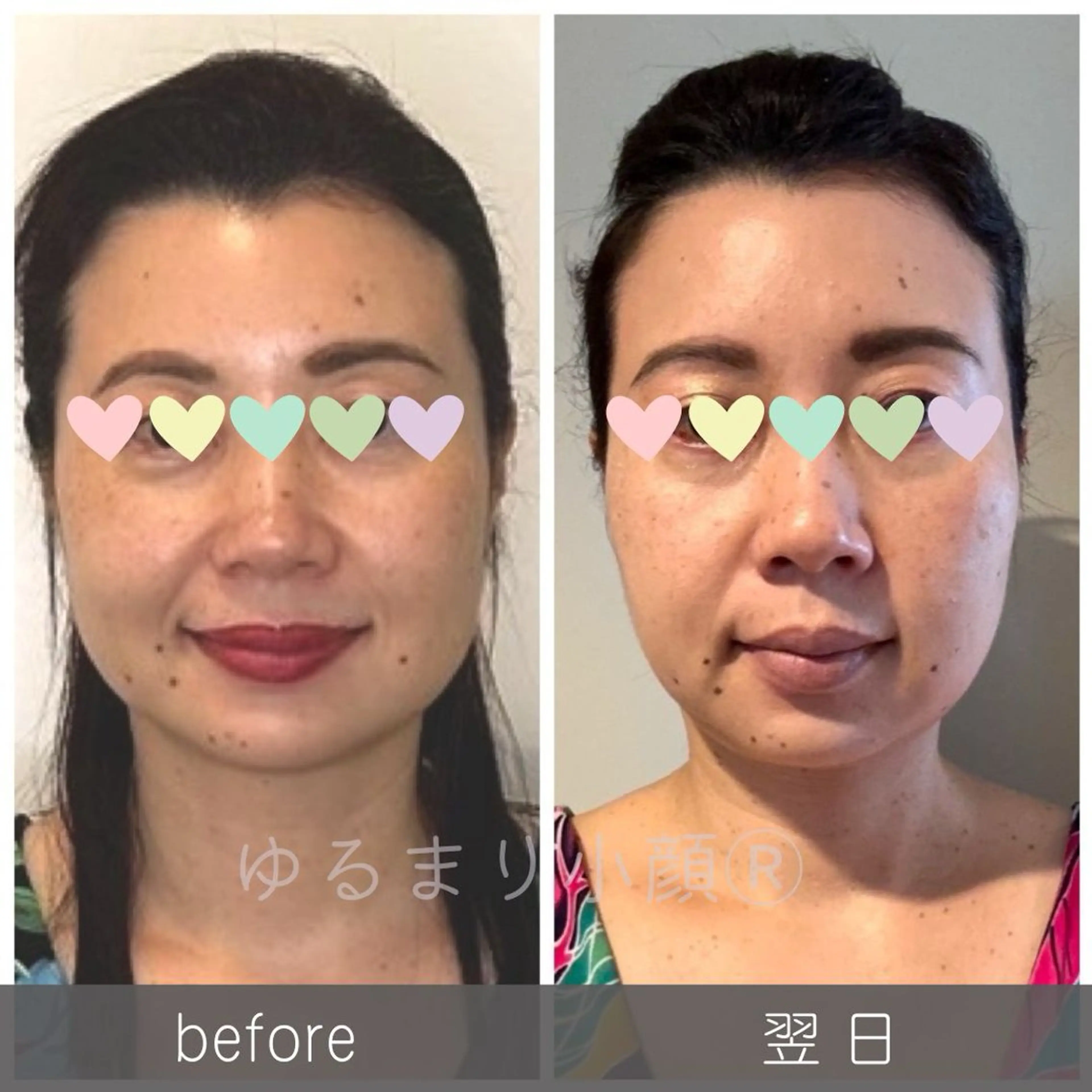 小顔矯正サロン町田 逸見智美のエステ・リラクイメージ