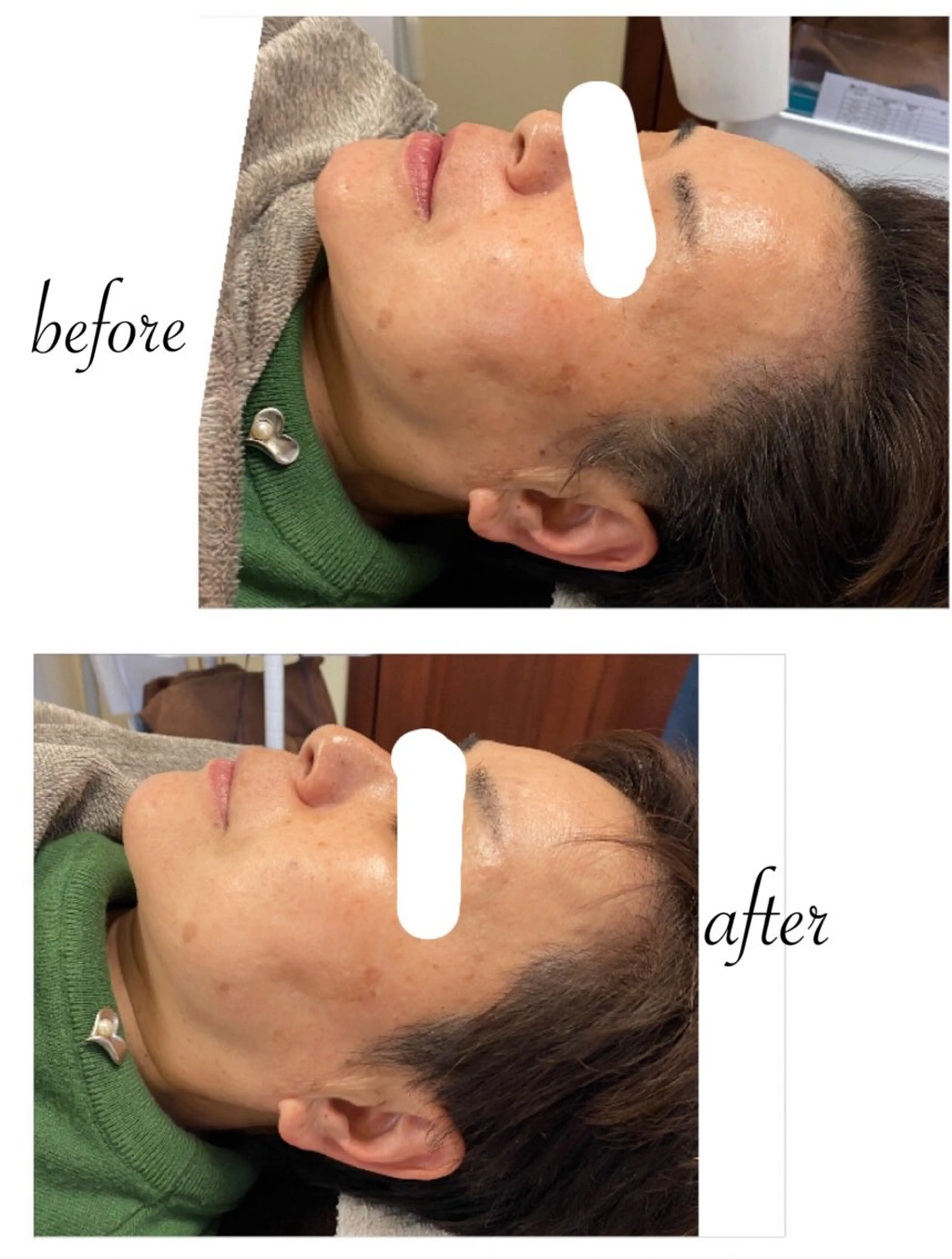 その他 ネイル＆脱毛 Lotus🌸のネイルデザイン