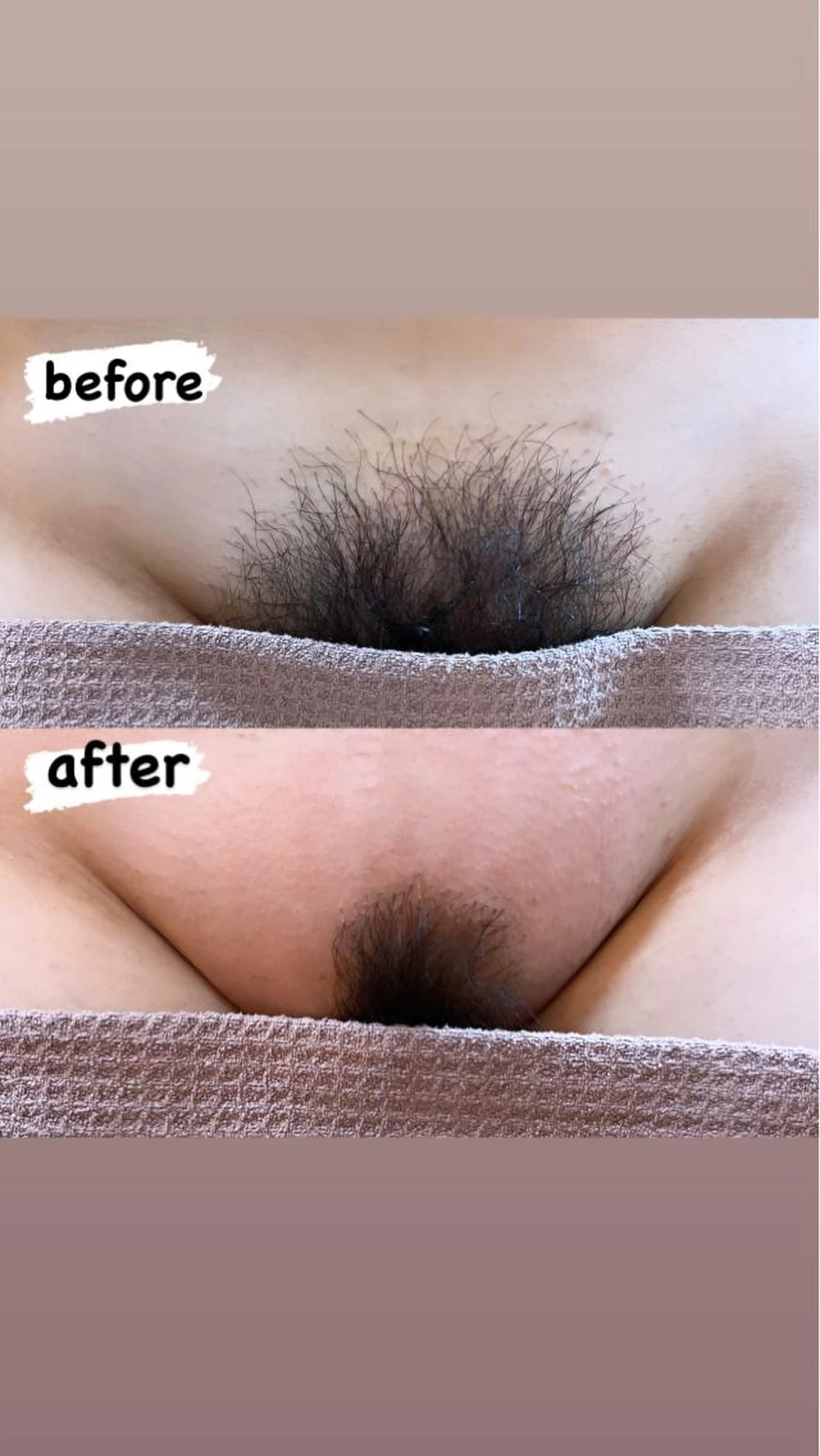 vioシュガーリングワックスの写真