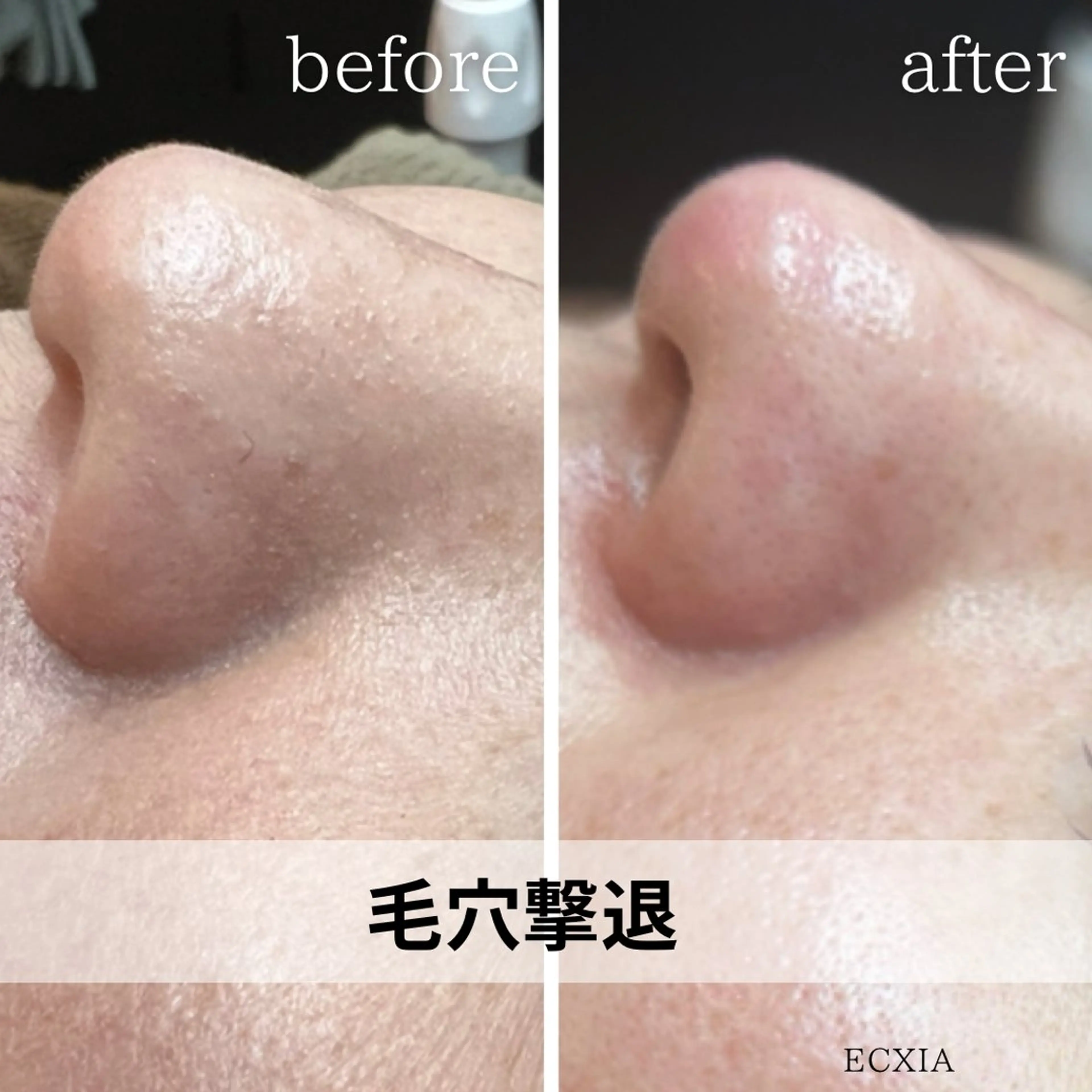 ECXIA 【エクシア】のエステ・リラクイメージ