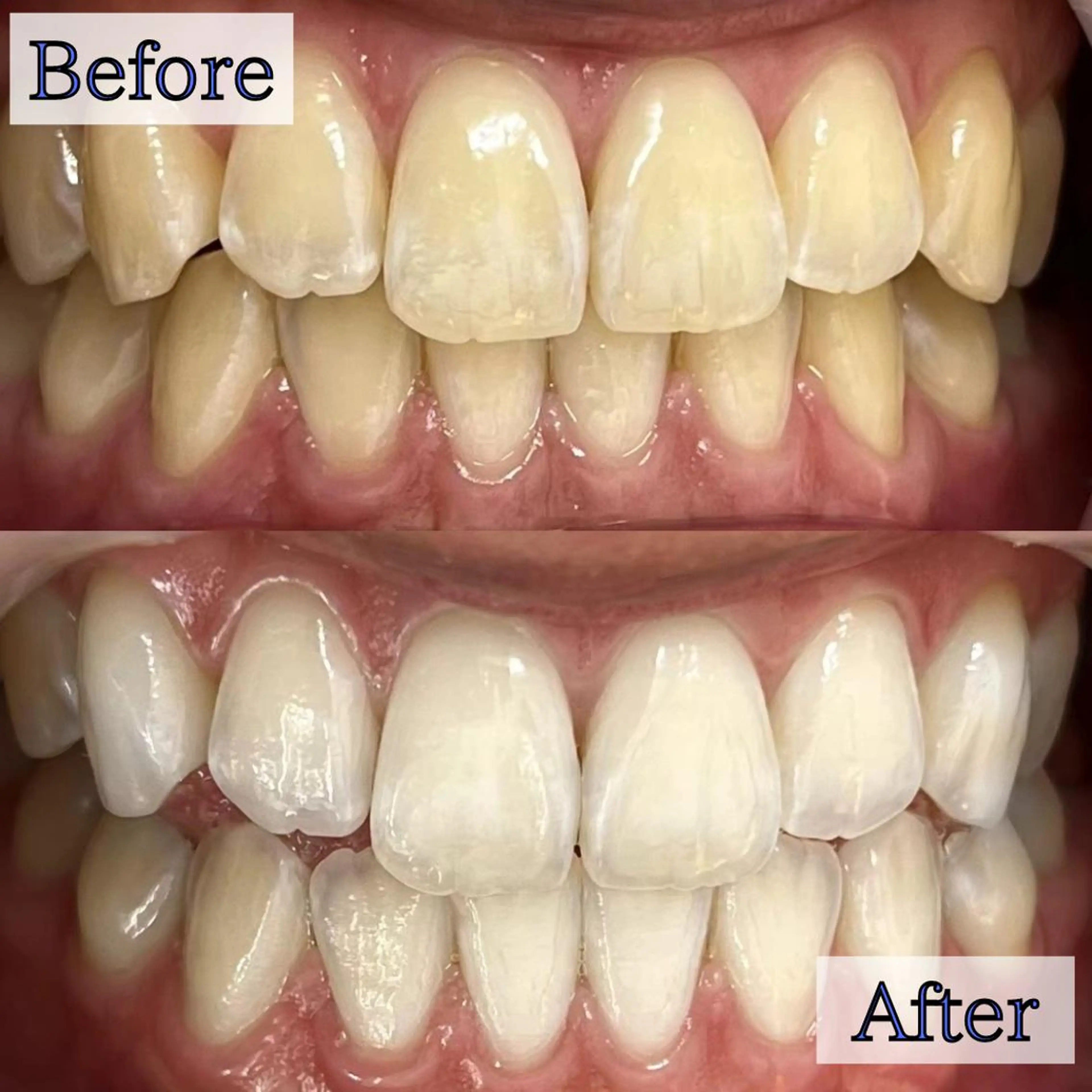 エステ リラク LBSホワイトニング 🌐渋谷店 公式のエステ・リラクイメージ