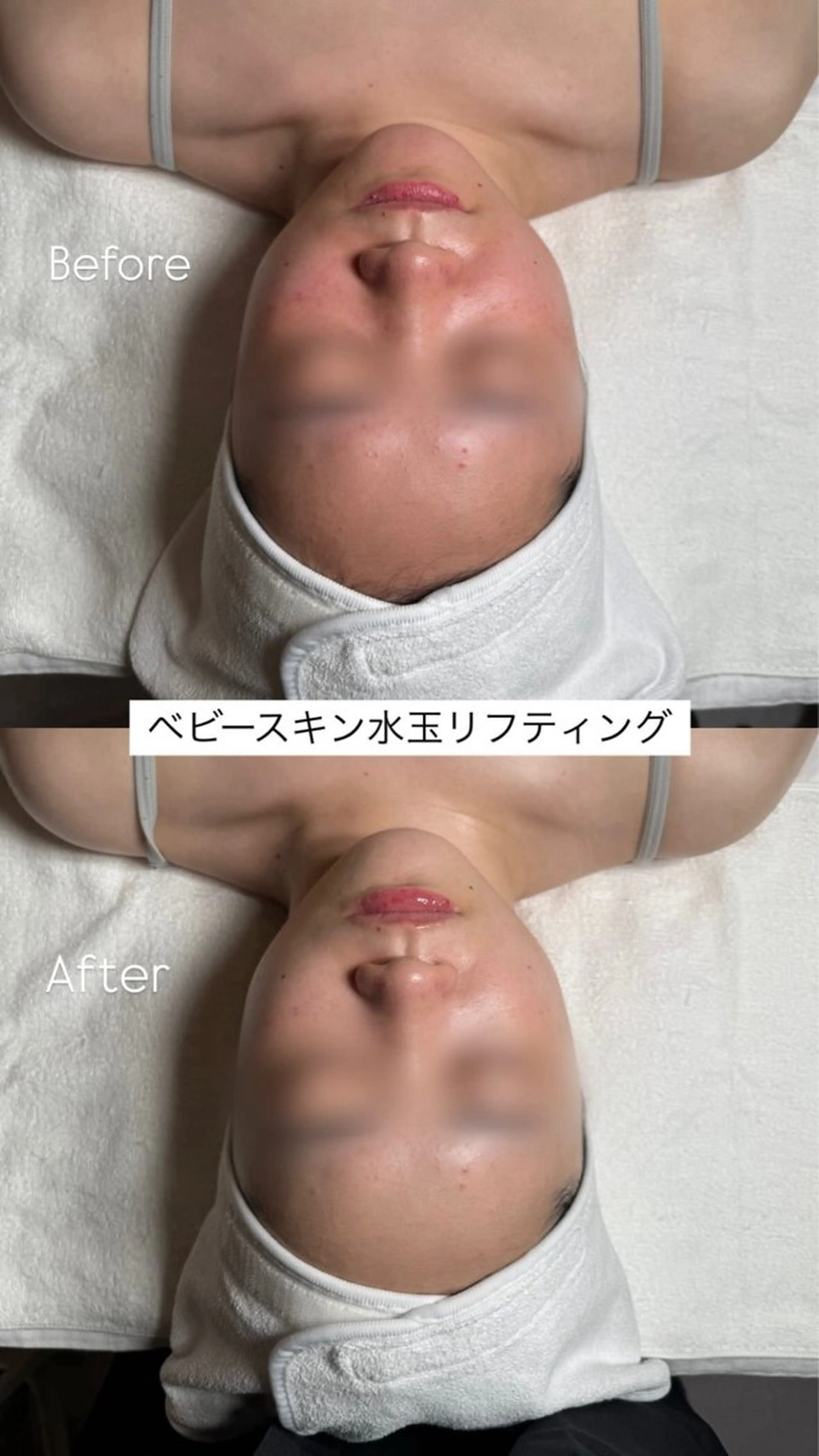 韓国肌管理🫧LDM 🫧Junnaのエステ・リラクイメージ