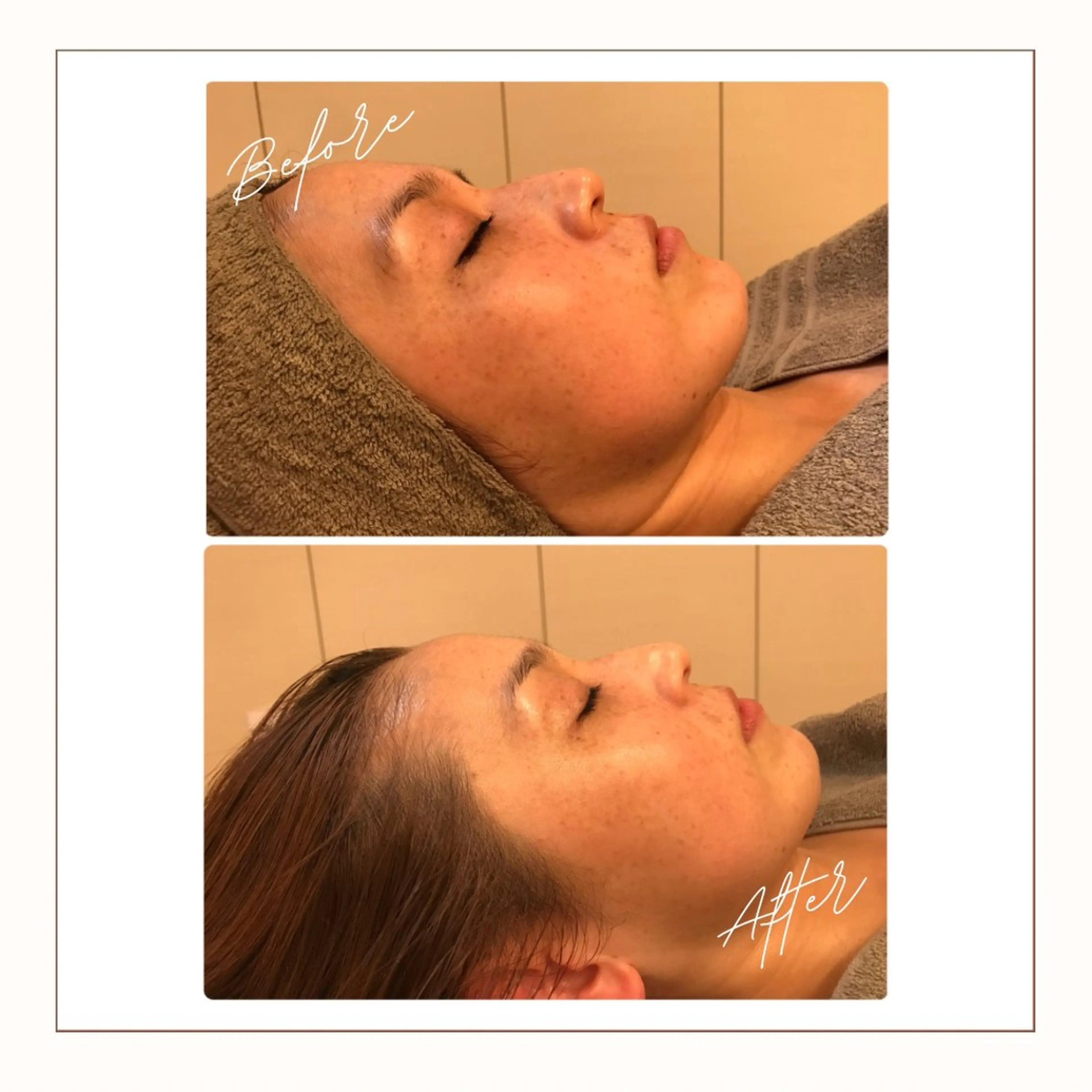 エステ リラク 小顔×肌質改善サロン soin〔ソワン〕のエステ・リラクイメージ