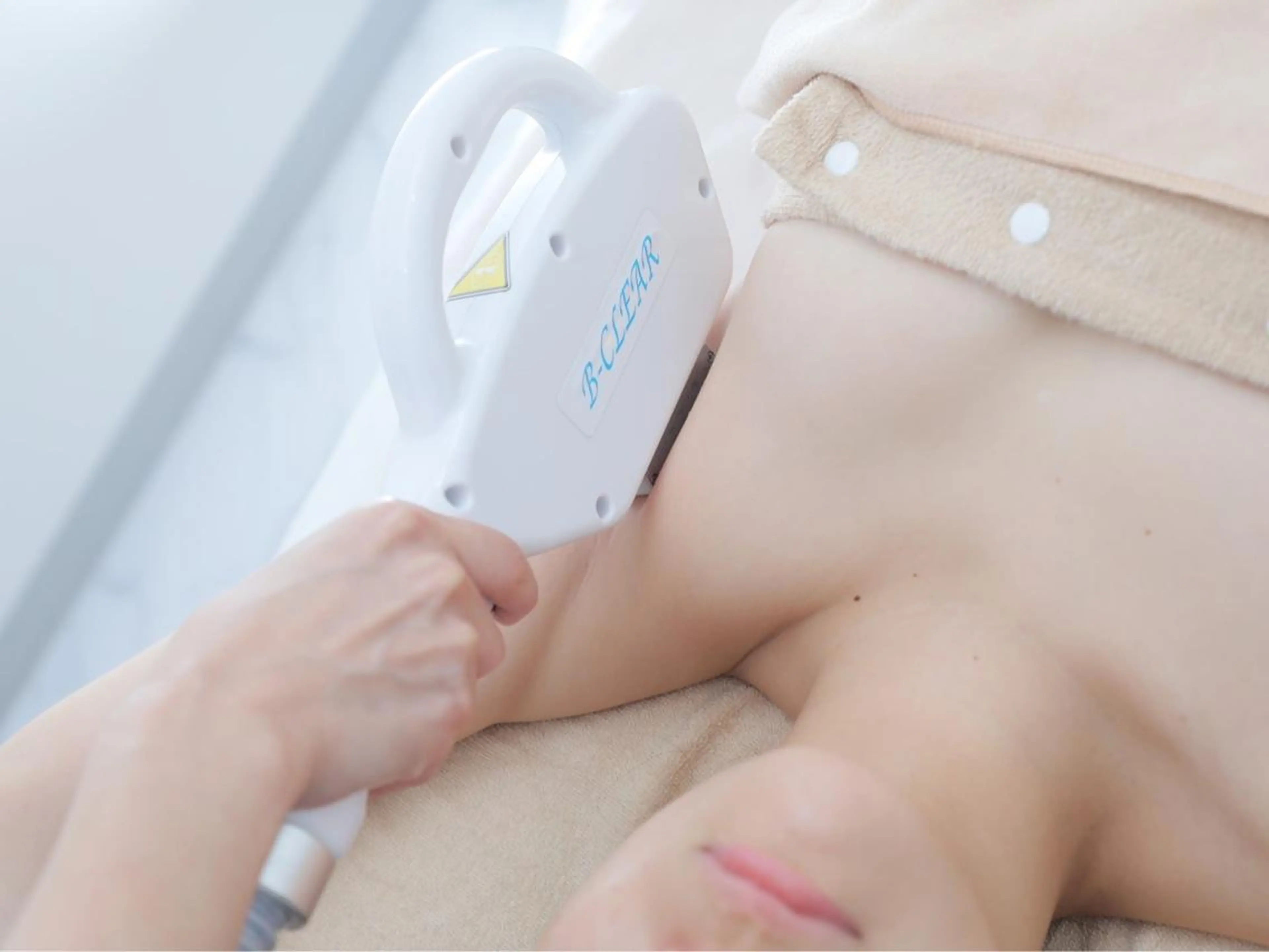 U24【うなじ脱毛】口コミ投稿OKな方★の写真