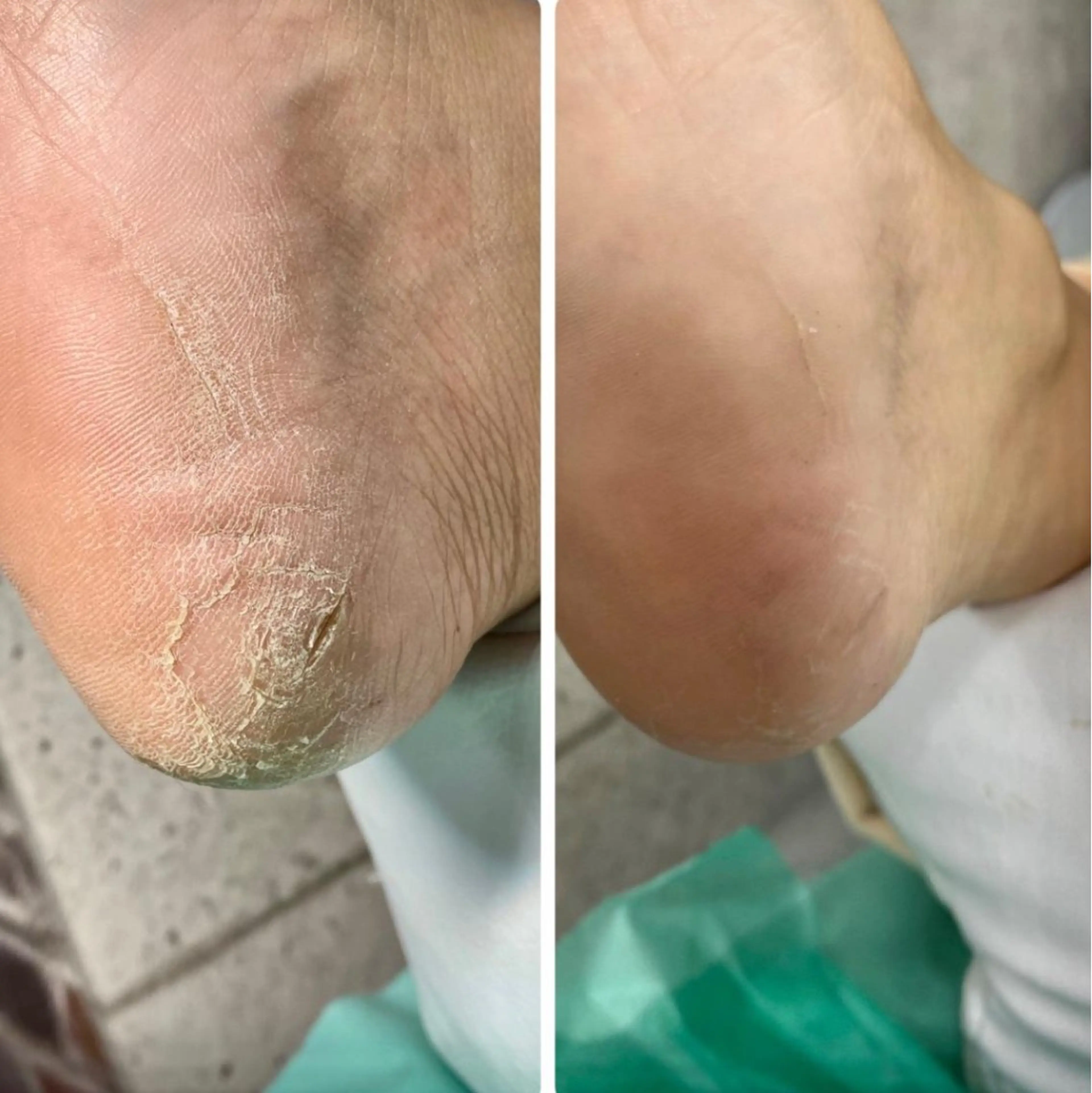 リラク 大宮巻き爪補正店所属・大宮 巻き爪補正店のエステ・リラクイメージ