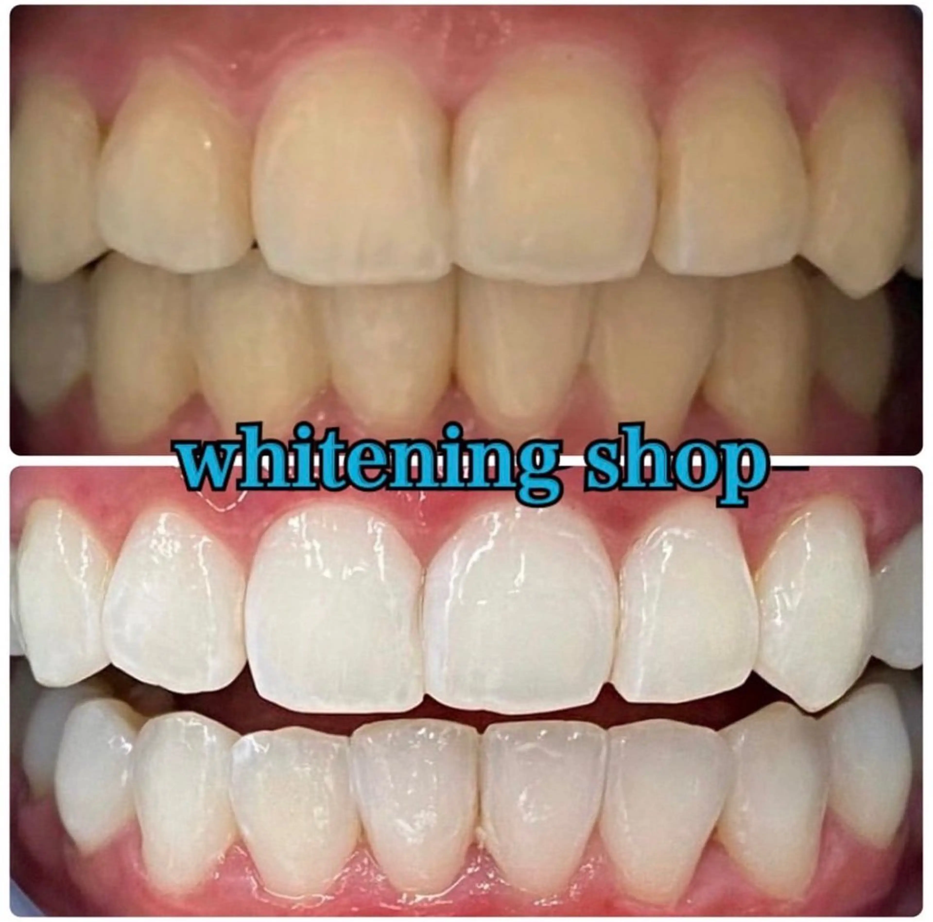 ホワイトニング ショップ吉祥寺店のエステ・リラクイメージ