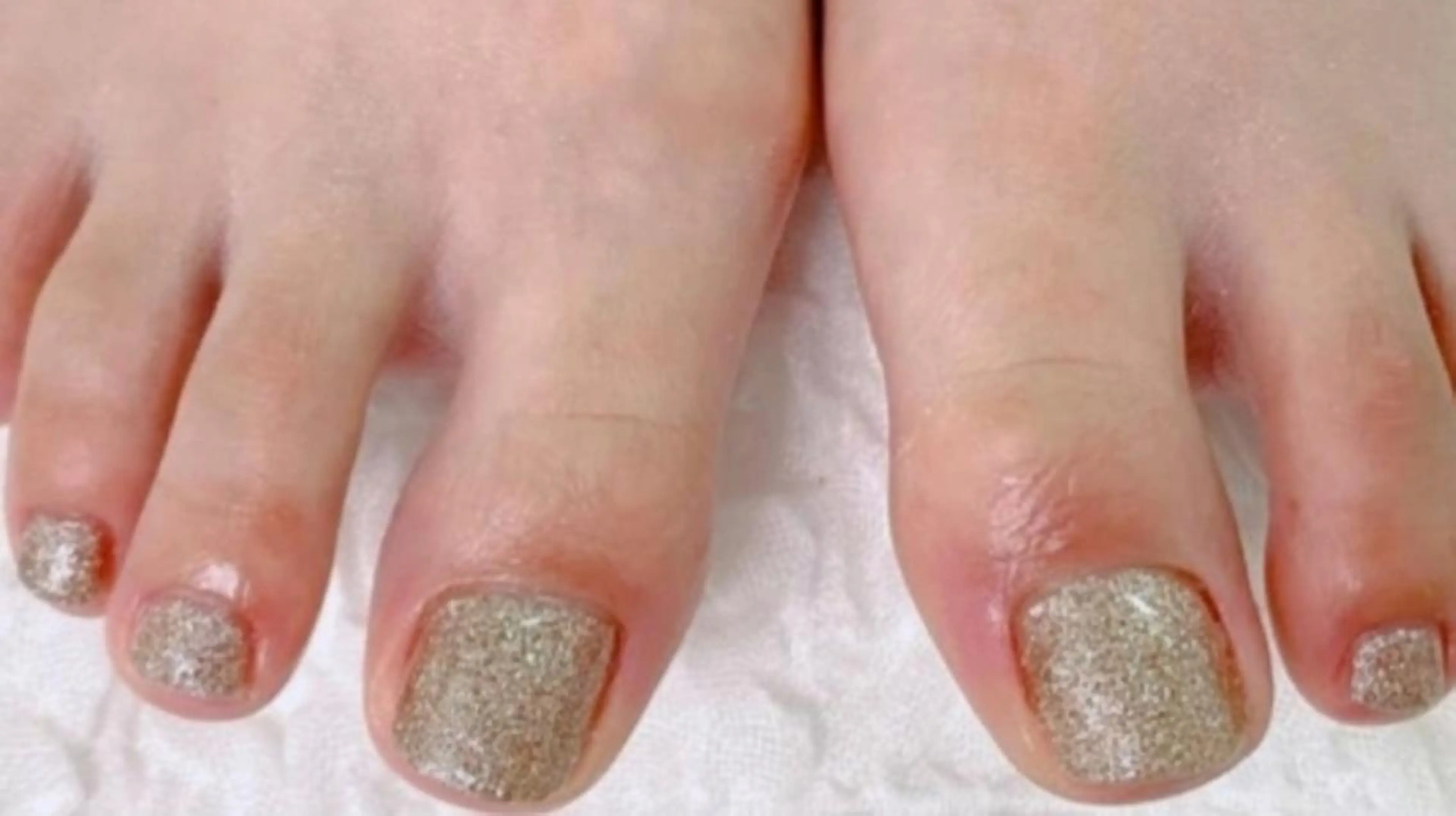 ネイル フットネイル Lisa Nailのネイルデザイン